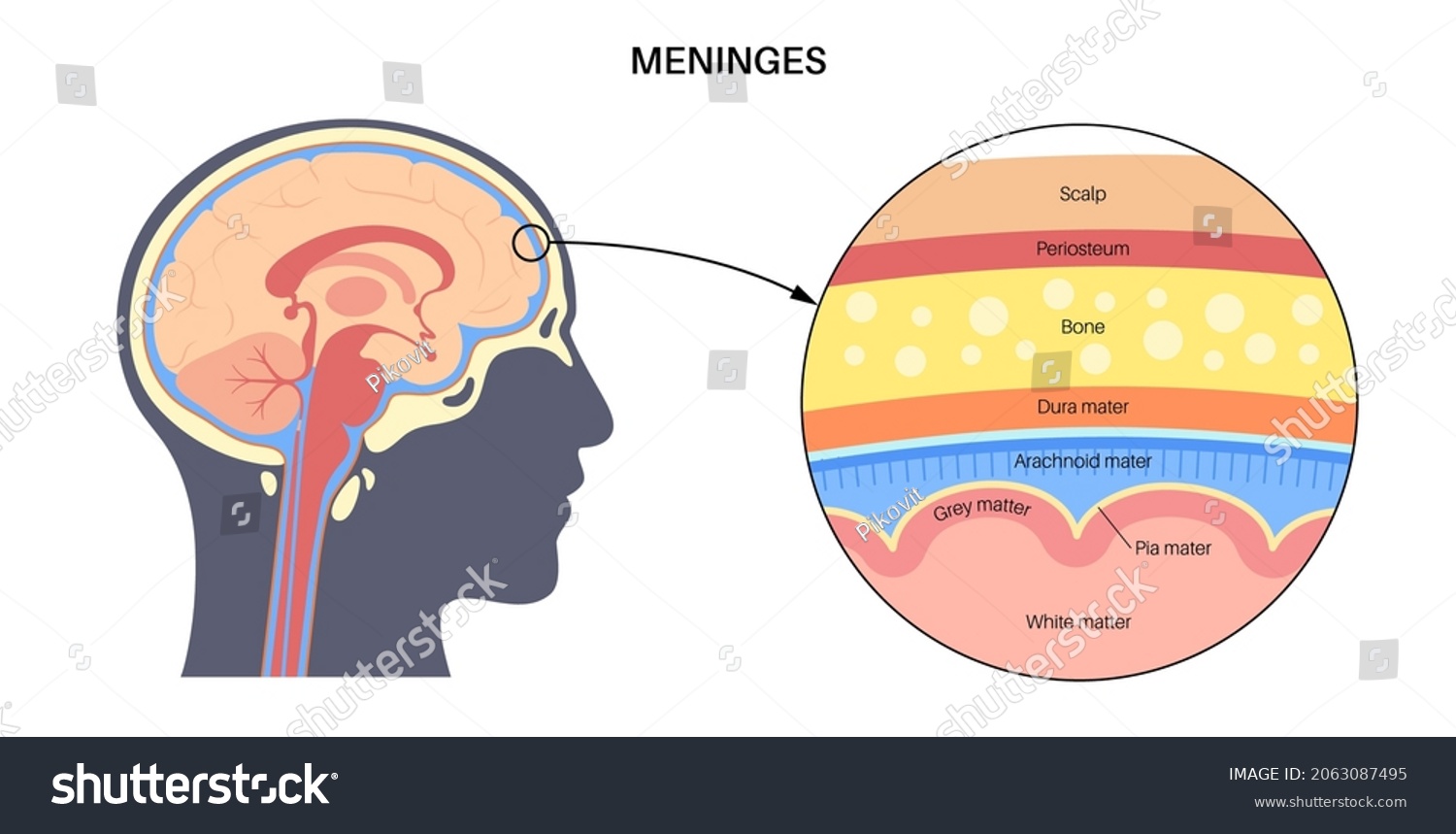 138 Meningococcal meningitis vector Images, Stock Photos & Vectors ...