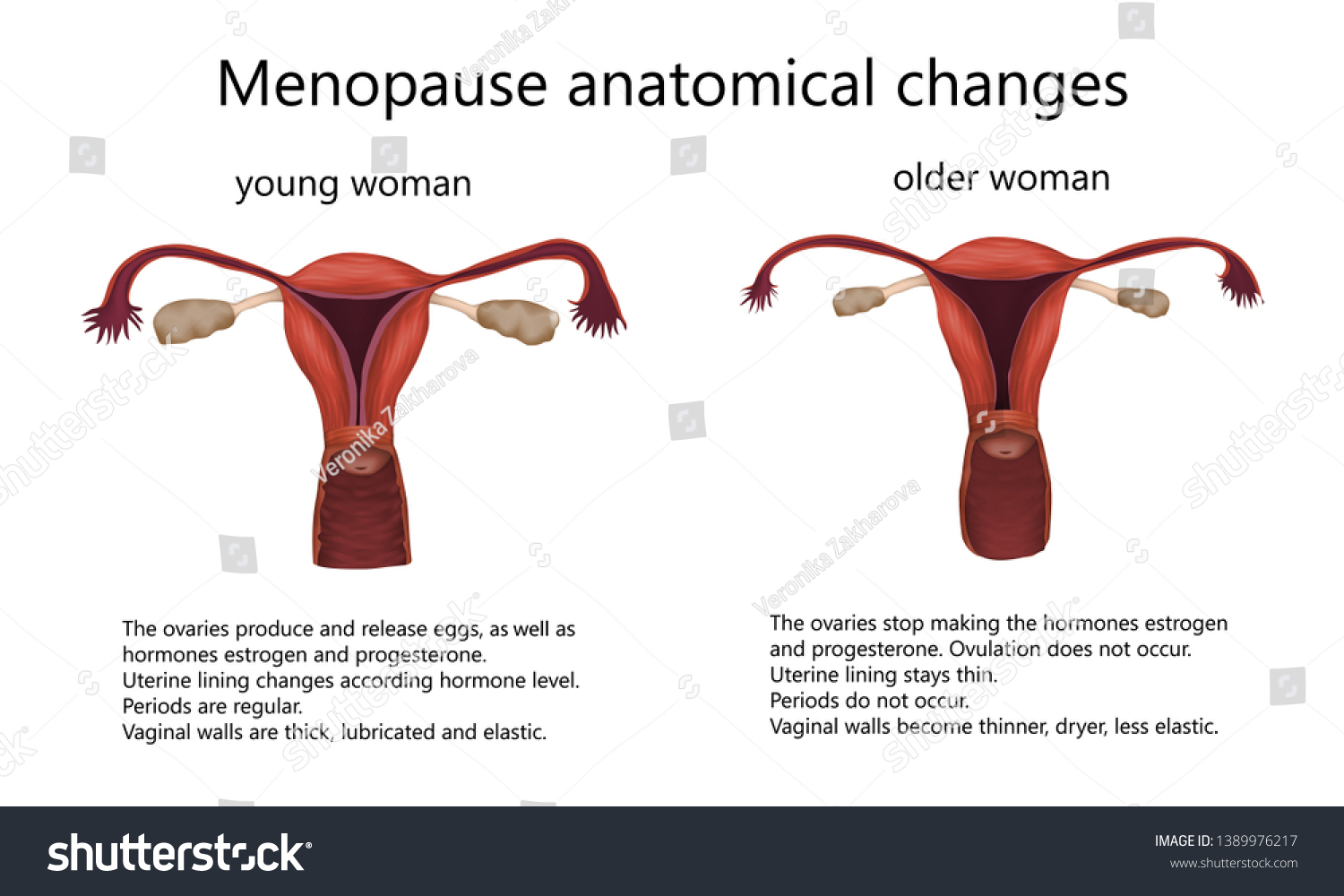 Menopause Anatomical Changes Comparison Female Reproductive Stock ...