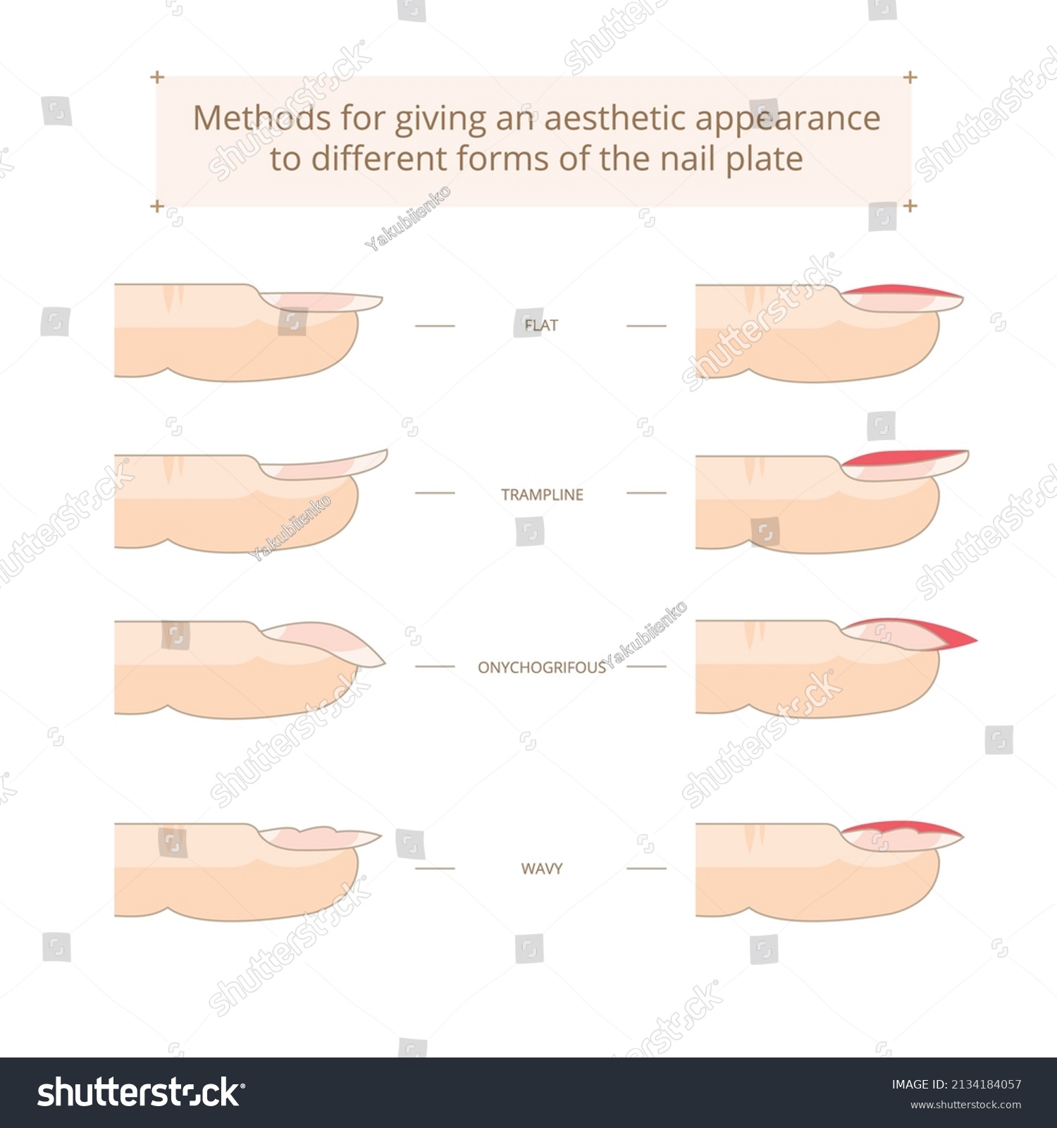 Methods Giving Aesthetic Appearance Various Forms Stock Vector (Royalty ...