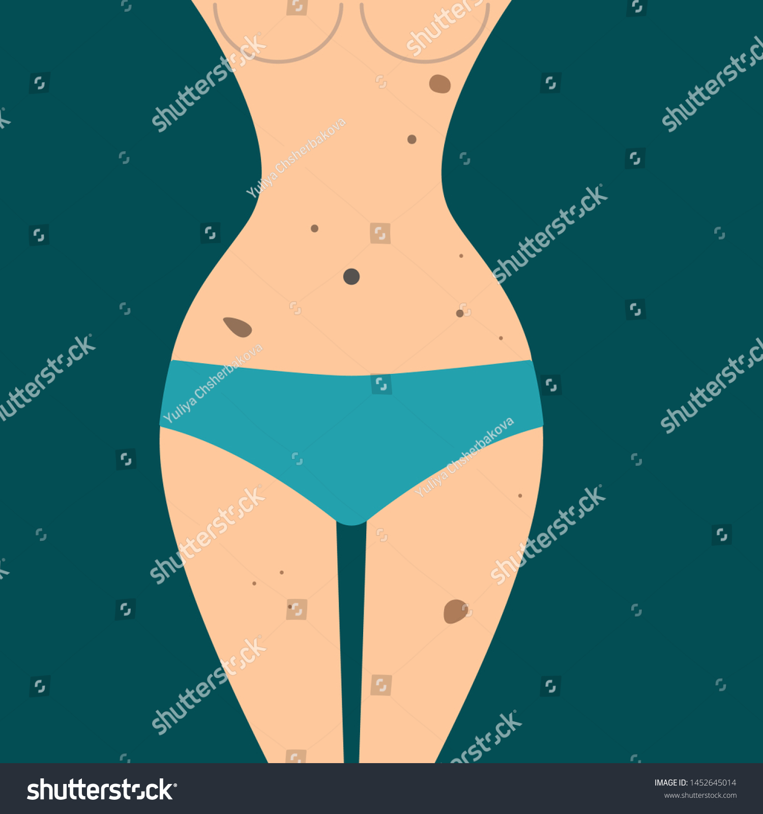 Moles On Female Body Vector Illustration Vetor Stock Livre De Direitos 1452645014 2825