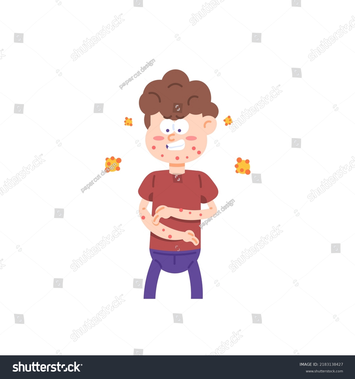 Monkeypox Virus Symptoms Chickenpox Lumps Pus Stock Vector (royalty 