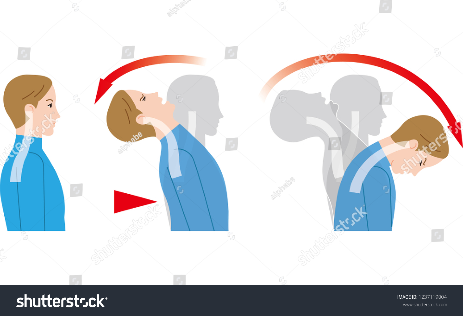 Movement Neck Due Impact Behind Whiplash Stock Vector (Royalty Free ...