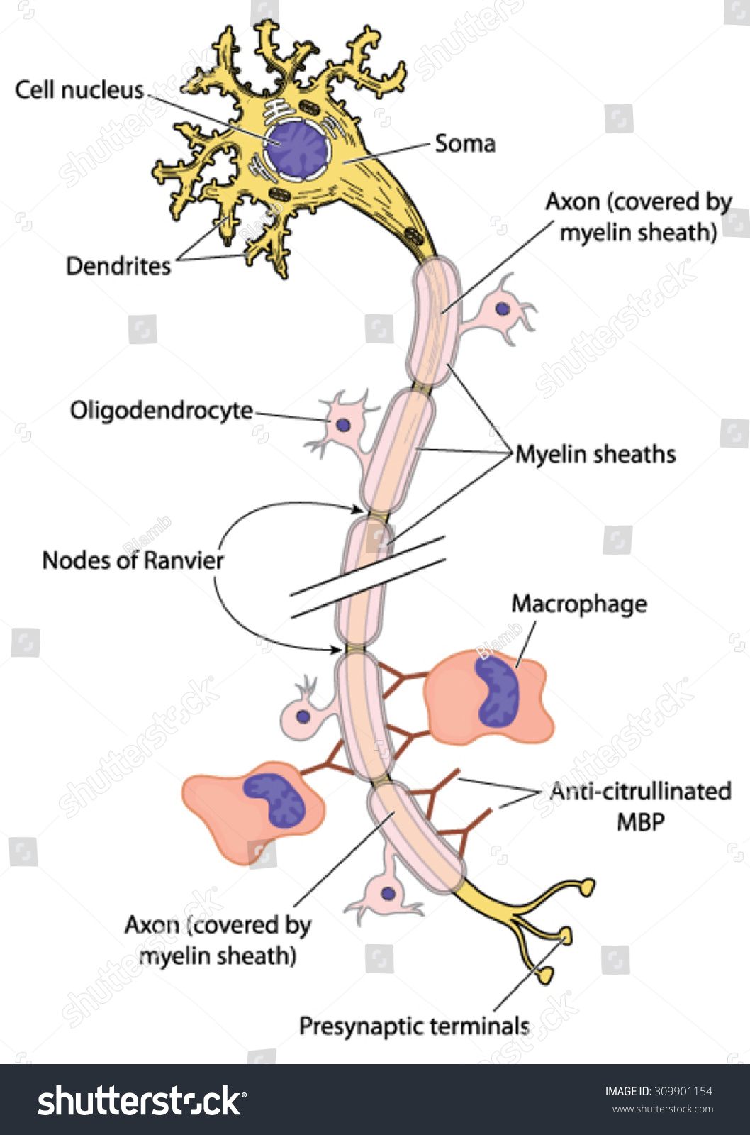 Myelinated Nerve Multiple Sclerosis Showing Action Stock Vector ...