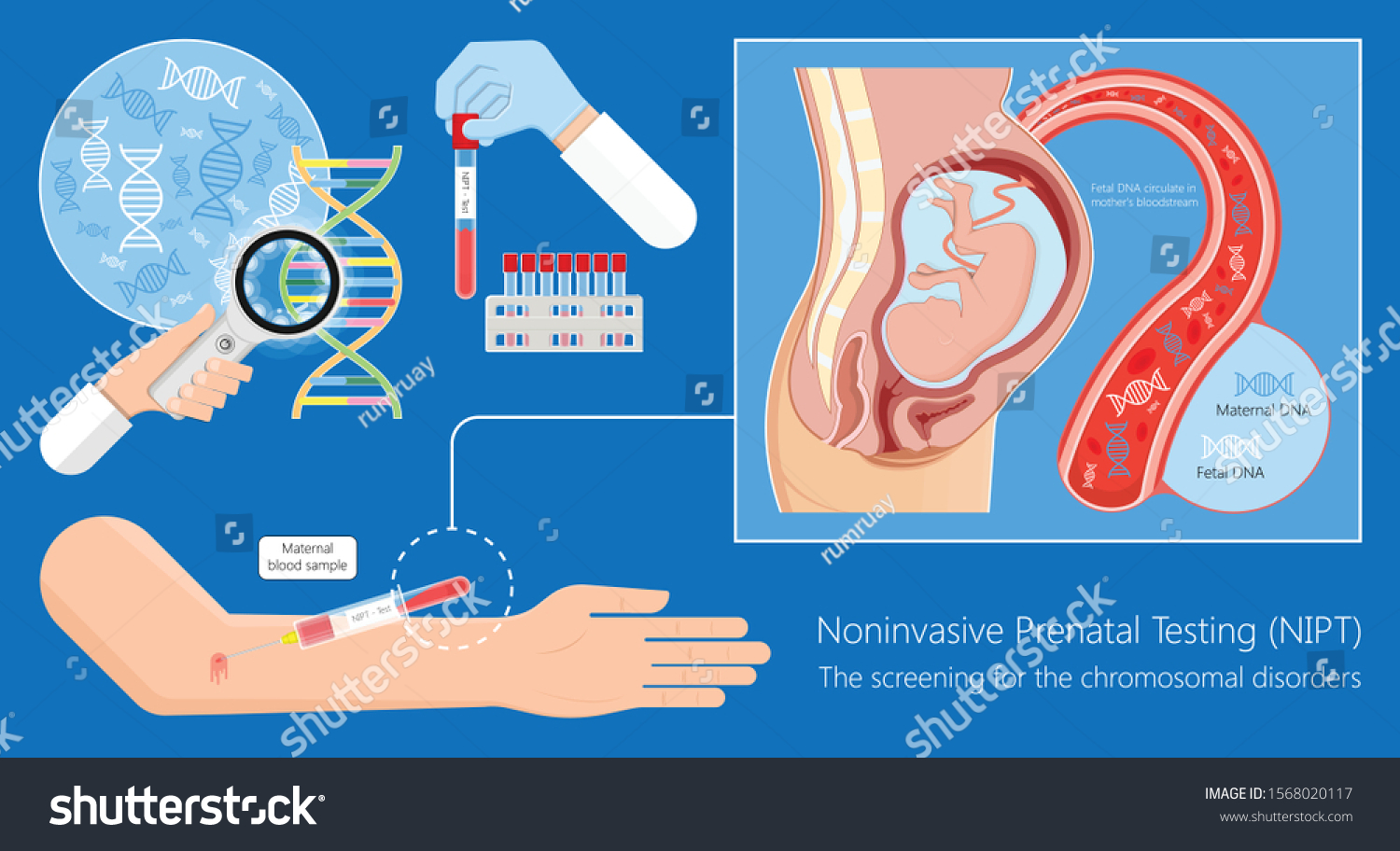 noninvasive-prenatal-testing-nipt-screening-genetic