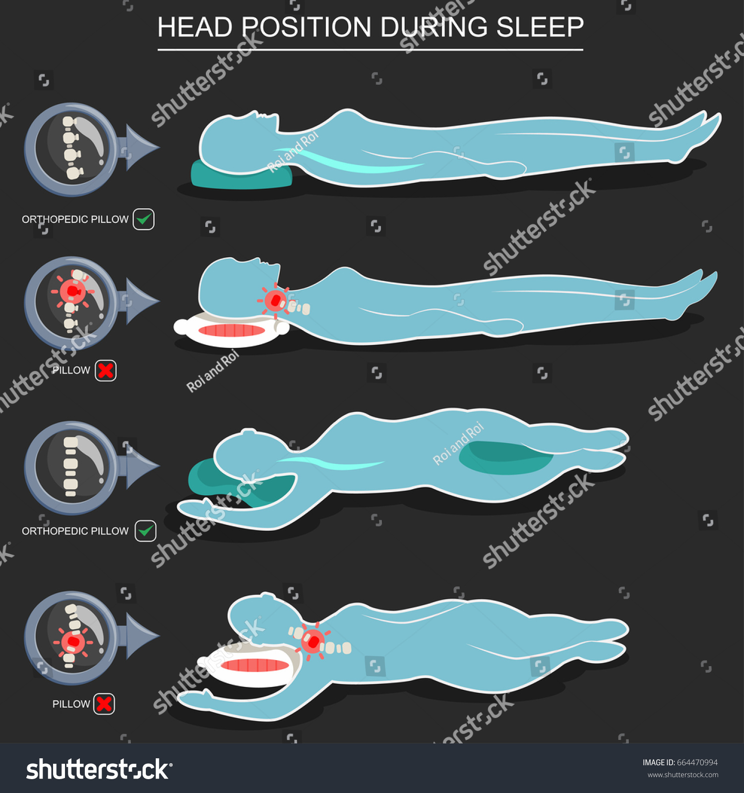 SVG of Orthopedic pillows for correct position of head during sleep. Vector illustration of the right and wrong posture of people lying on the back and side. Medical infographic for a healthy spine and neck. svg