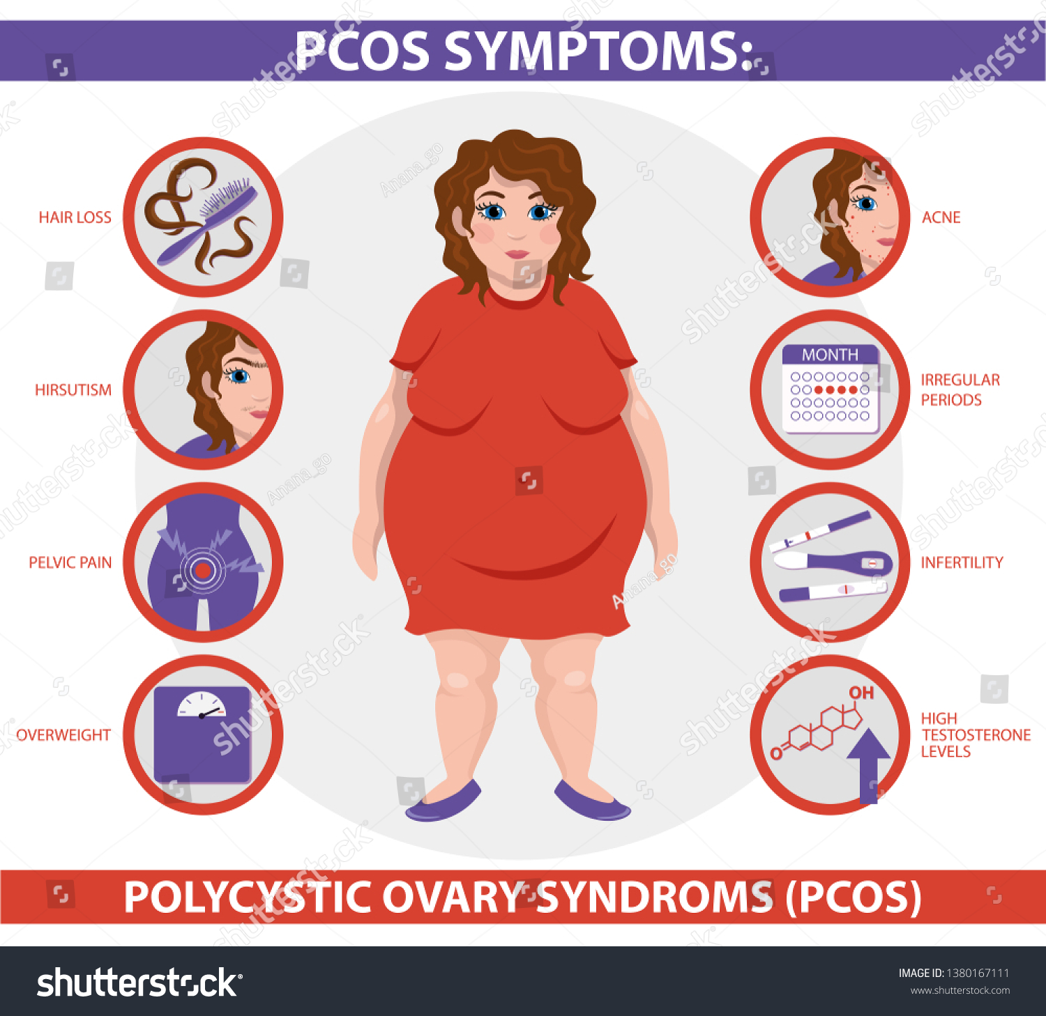 Infographie Des Sympt mes PCOS Syndrome Ovaire Image Vectorielle De 
