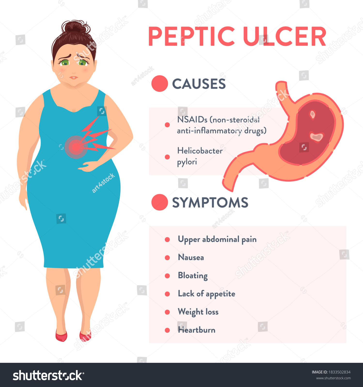 Vektor Stok Peptic Ulcer Stomach Disease Infographic Poster (Tanpa ...