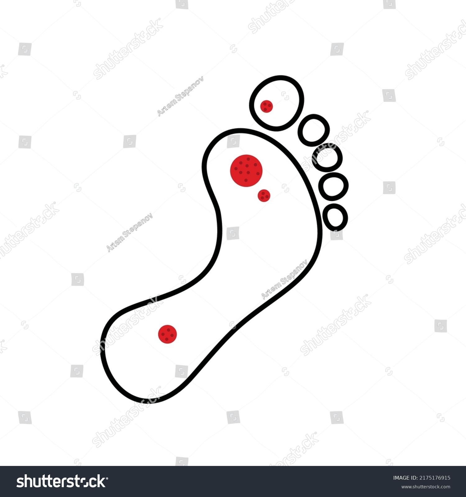 Plantar Wart Icon Verruca Symbol Foot Stock Vector (Royalty Free ...