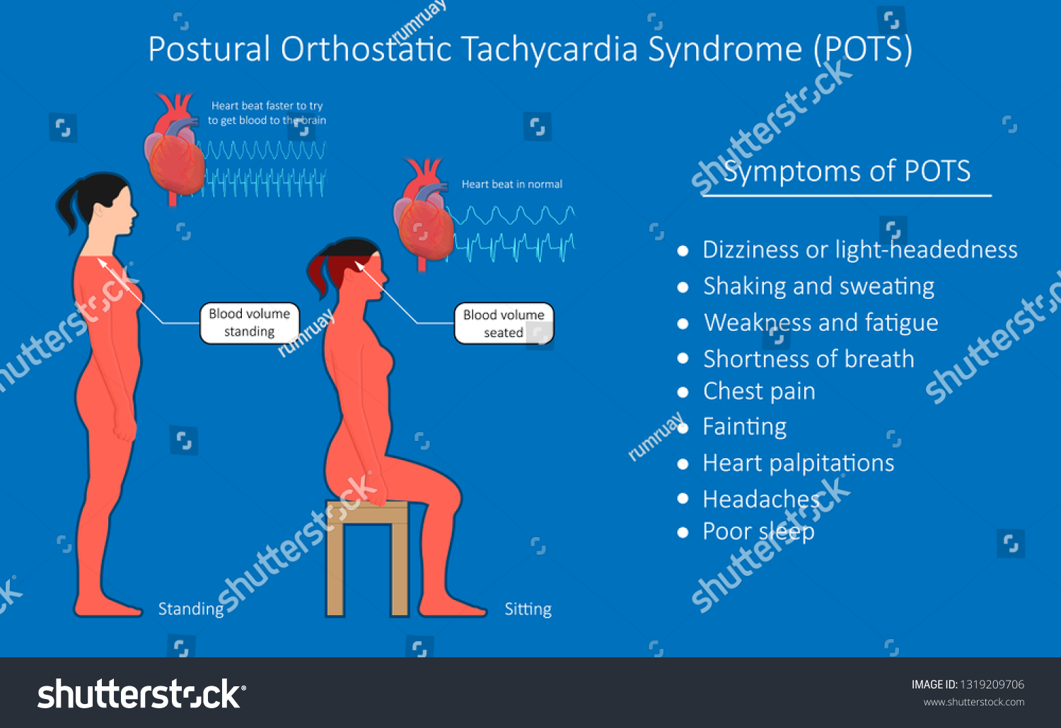 13-postural-orthostatic-tachycardia-syndrome-images-stock-photos