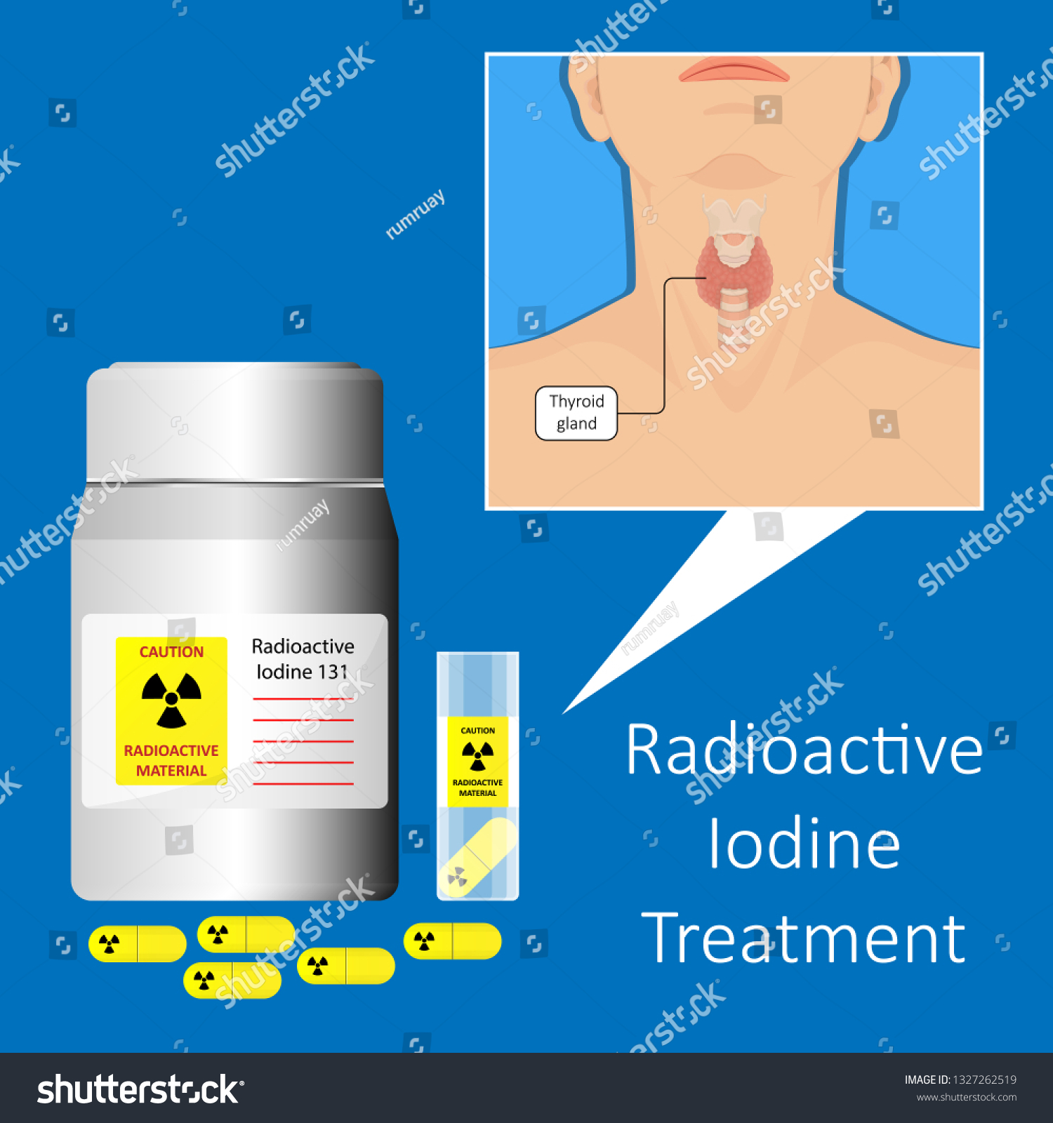 Radioactive Iodine Radioiodine I131 Therapy Treatment Stock Vector Royalty Free 1327262519