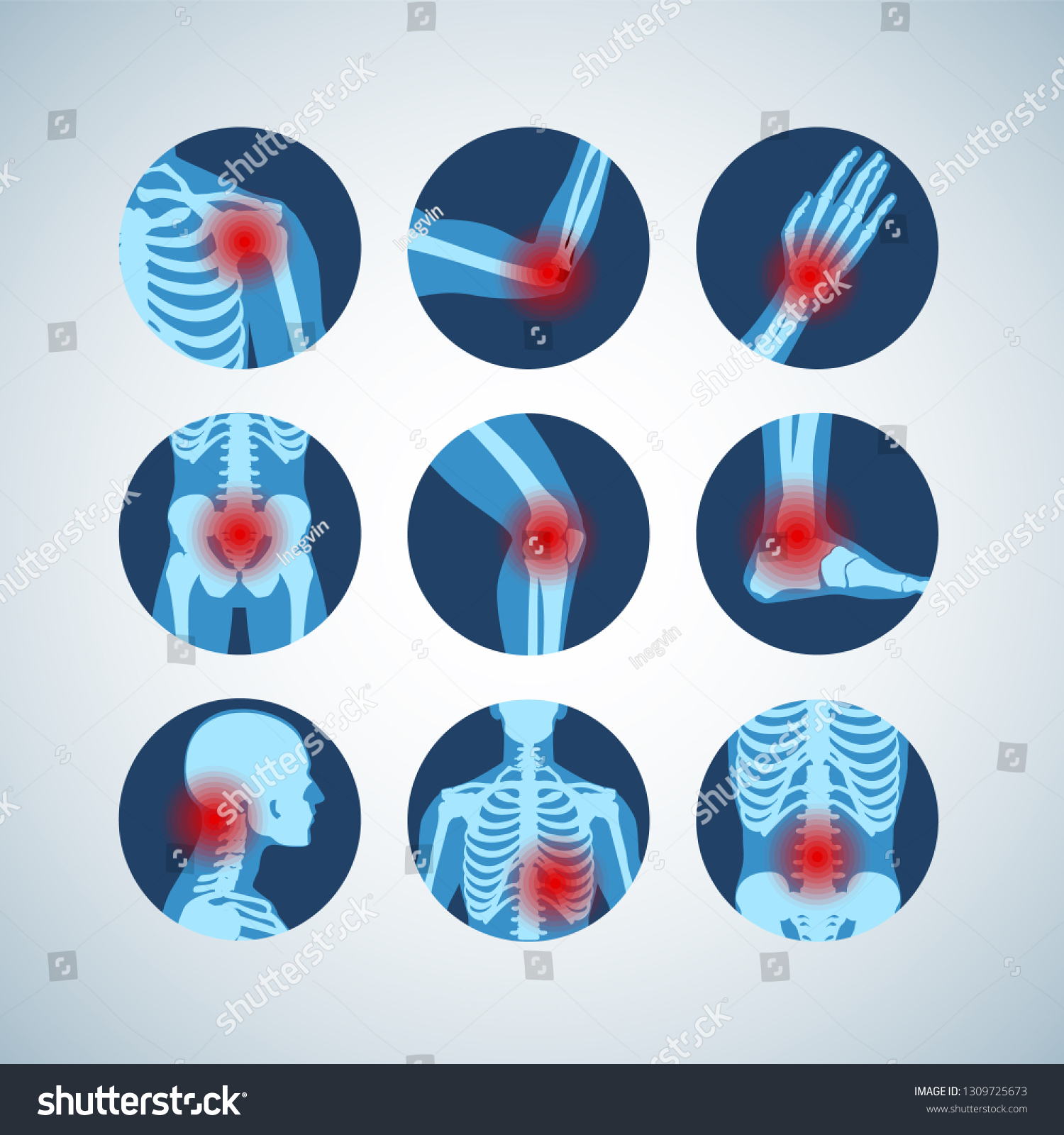 9,227 Bone joint infographic Images, Stock Photos & Vectors | Shutterstock