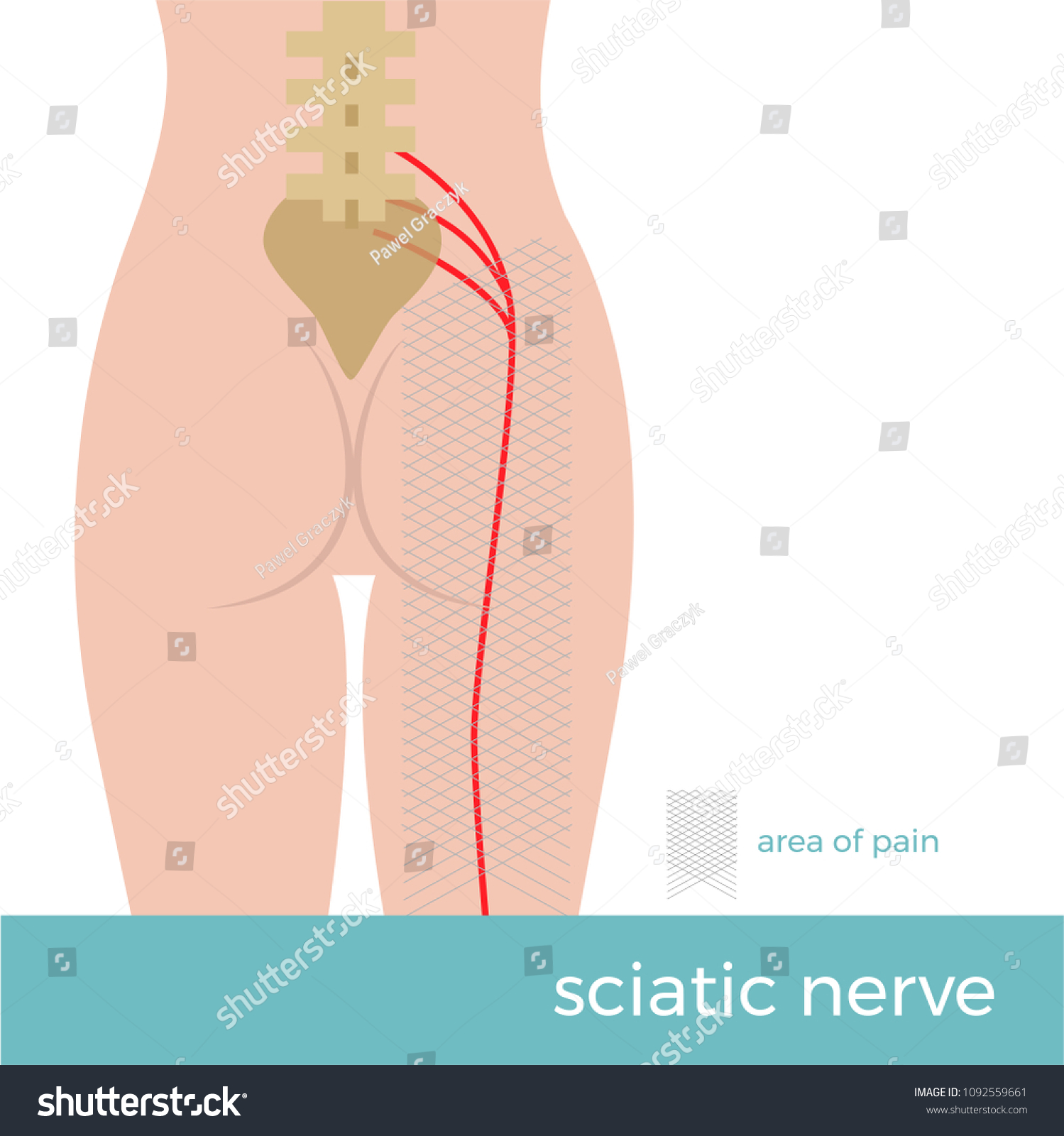 Sciatic Nerve Anatomy Illustration Showing Schematic 库存矢量图（免版税）1092559661 Shutterstock 0083