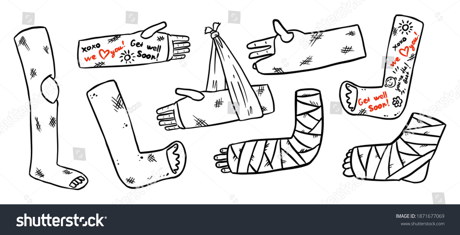 SVG of Set of broken legs, arms and hands cast doodles with positive writings from friends. Collection of injured limbs in gypsum plasters. Get well soon wishes. Media glyph graphic icons svg