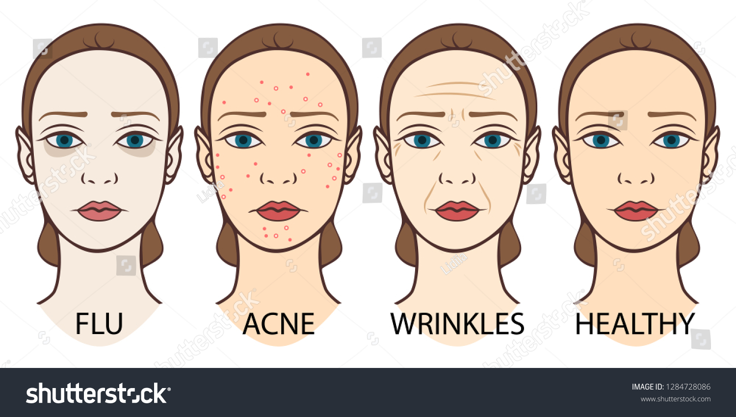 13 Akne face Images, Stock Photos & Vectors | Shutterstock