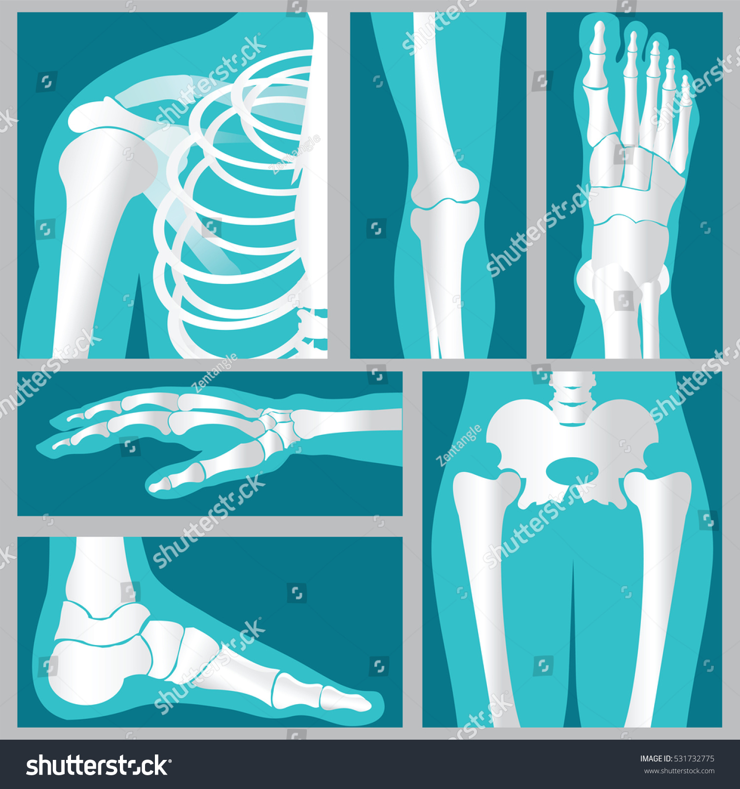 19.330 Ilustrações De Orthopedic Injuries Ilustrações, Imagens E ...