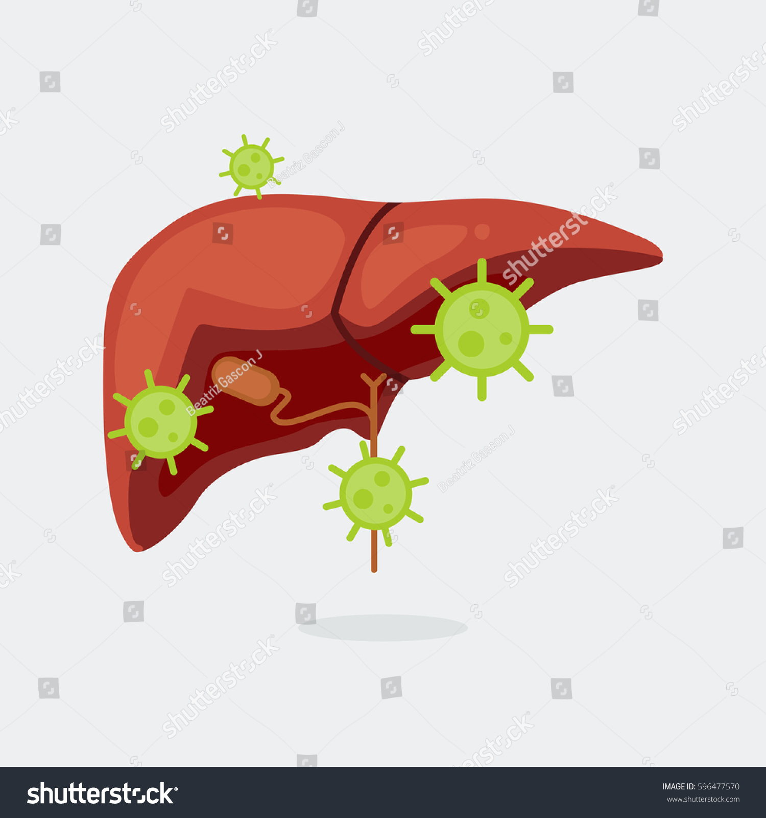 病気の肝臓のベクターイラスト のベクター画像素材 ロイヤリティフリー