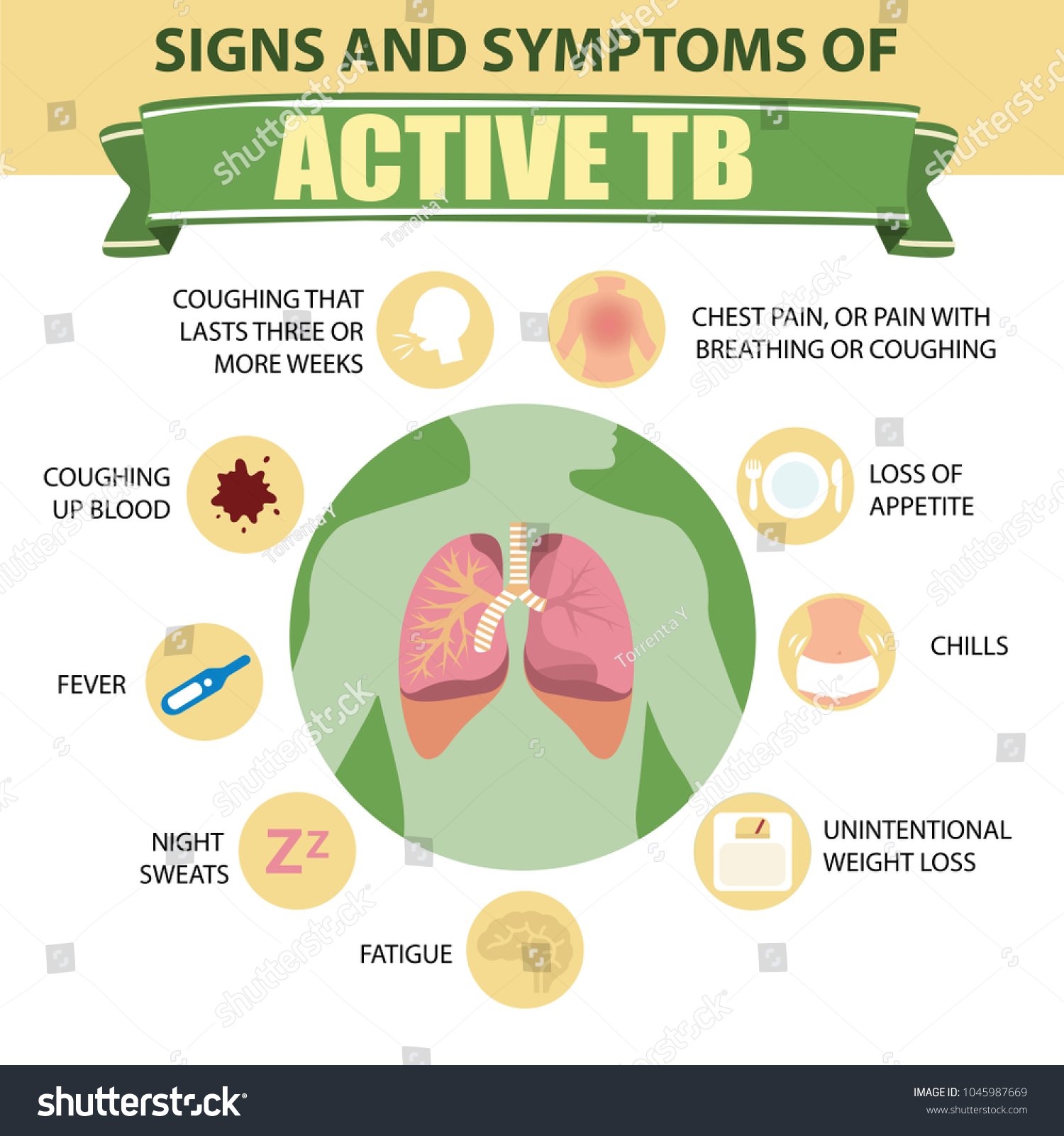 Pulmonary tuberculosis: symptoms and treatment 54 Pulmonary tuberculosis: symptoms and treatment 65