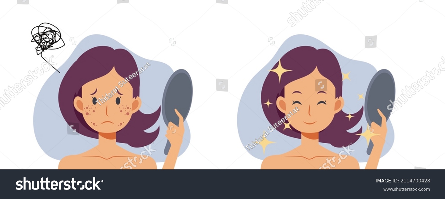 SVG of Skin care concept.woman,girl with acne.Before and after acne.Flat vector 2d cartoob character illustration. svg