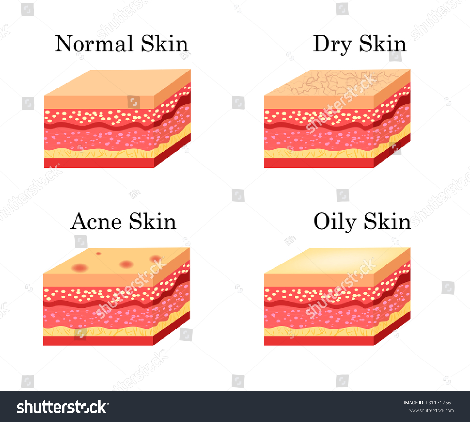 5,967 Normal skin face Images, Stock Photos & Vectors | Shutterstock