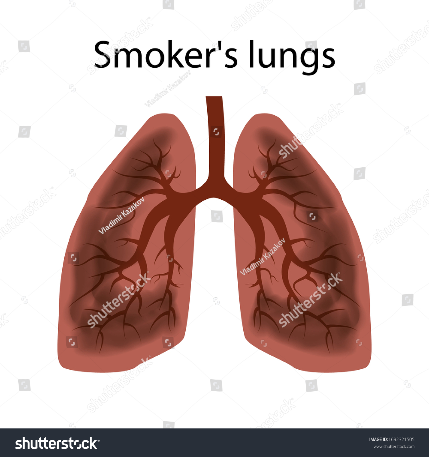 Smokers Lungs Damage Lungs Person Caused Stock Vector (Royalty Free ...