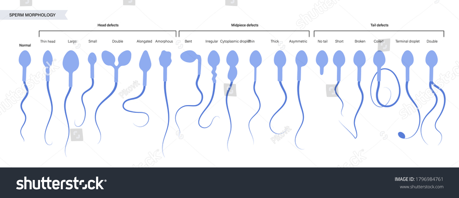 male-fertility-how-everyday-chemicals-are-destroying-sperm-counts-in