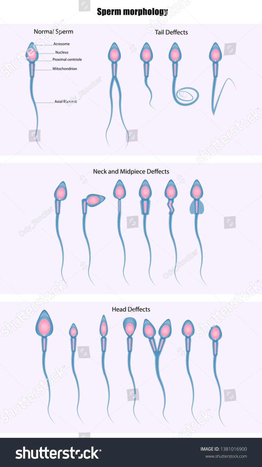 Sperm Morphology Semen Analysis Vector Illustration Stock Vector Royalty Free 1381016900 