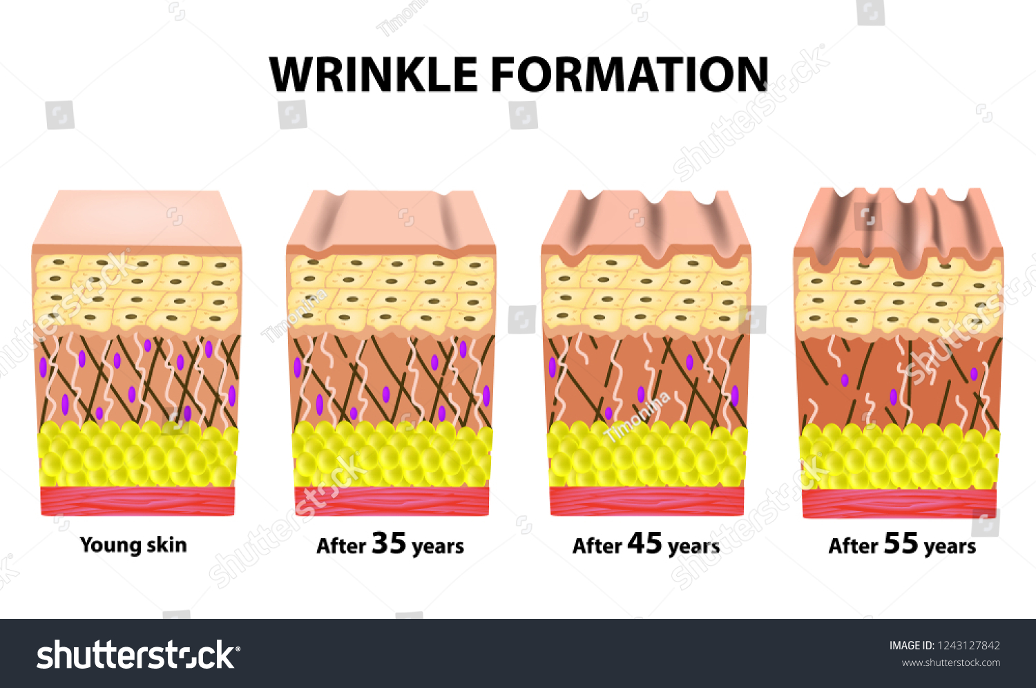 Stages Wrinkles Different Ages Anatomical Structure Stock Vector Royalty Free