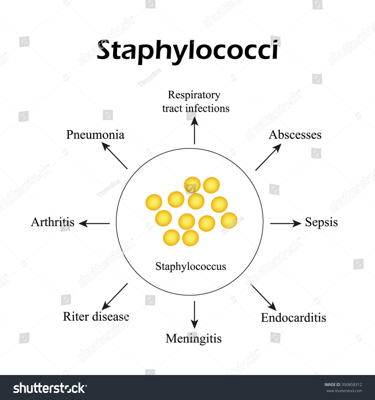 Staphylococci Staphylococcus Aureus Causes Diseases Infographics