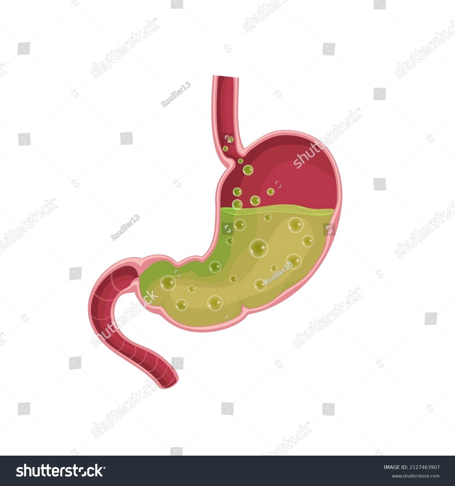 Stomach Nausea Diseases Stomach Vomiting Flat Stock Vector (Royalty ...