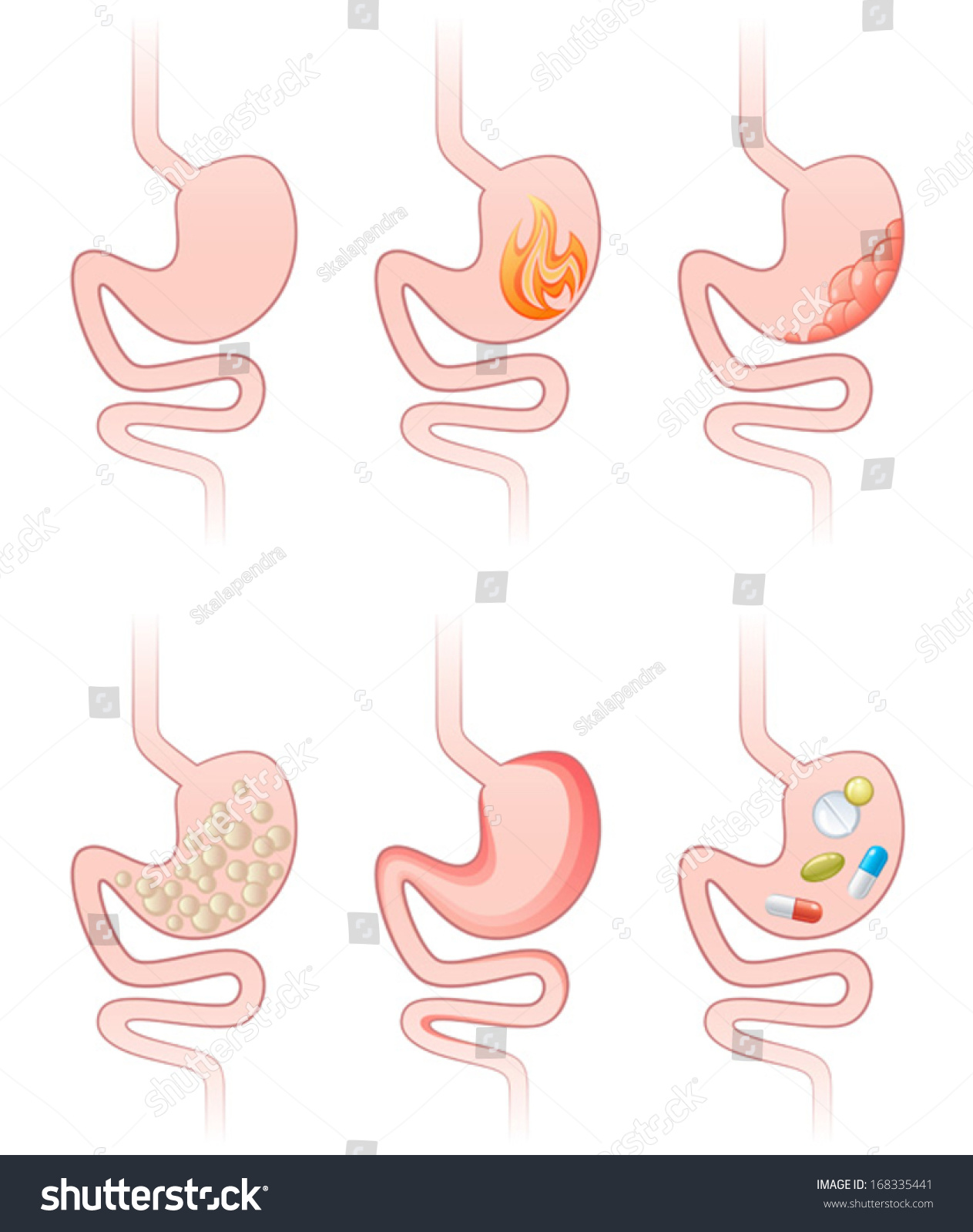 Stomach Sick Stock Vector (Royalty Free) 168335441