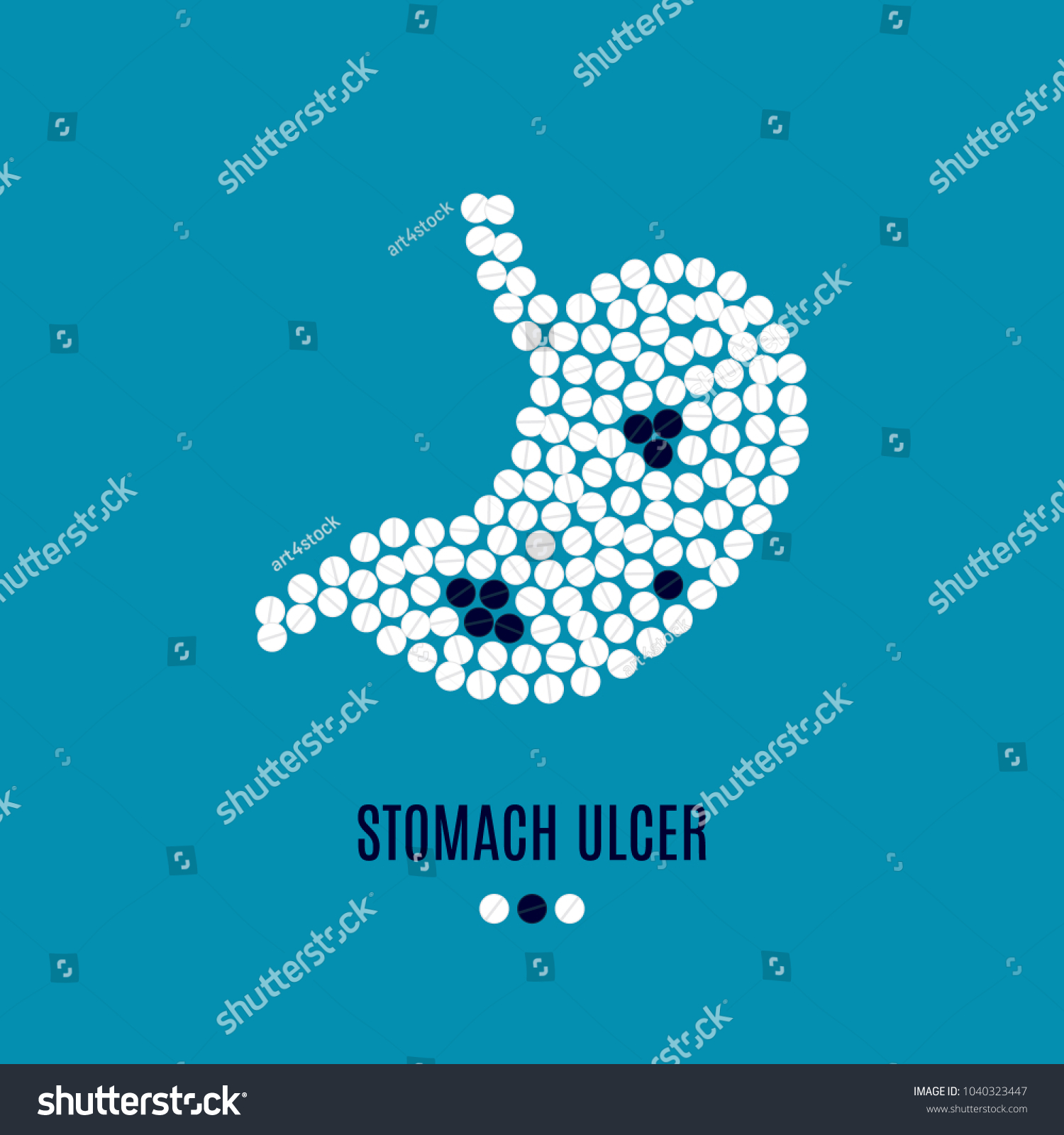 Stomach Ulcer Awareness Vector Poster Stomach 1040323447 stomach-ulcer-awareness-vector-poster-stomach-1040323447
