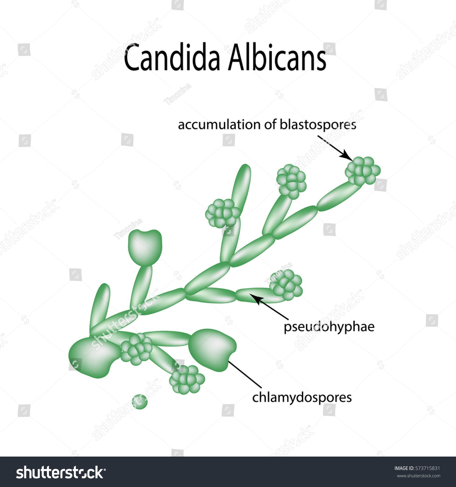 Structure Candida Albicans Infographics Vector Illustration 스톡 벡터(로열티 ...