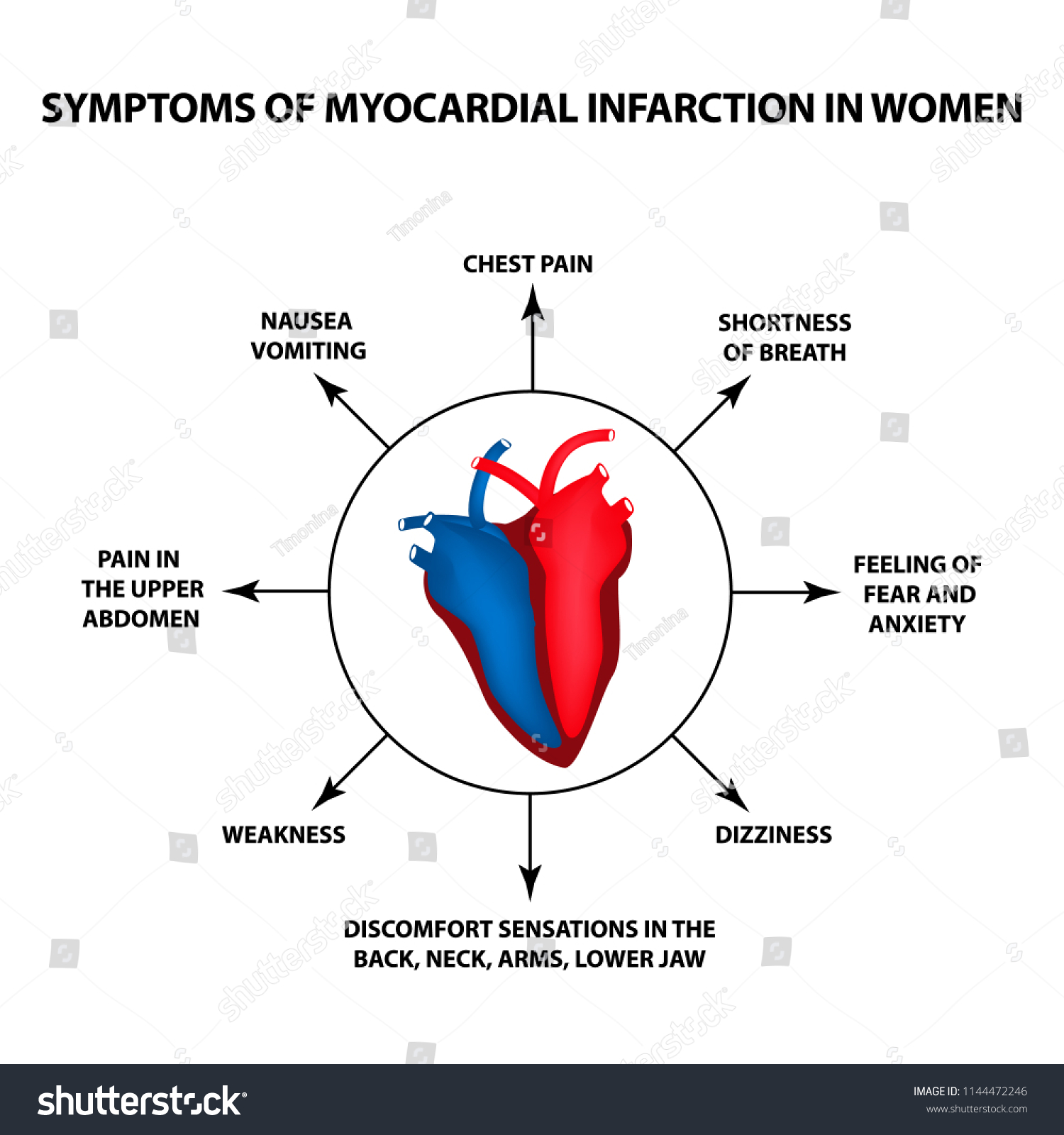 Symptoms Myocardial Infarction Women Heart Attack Stock Vector Royalty Free 1144472246