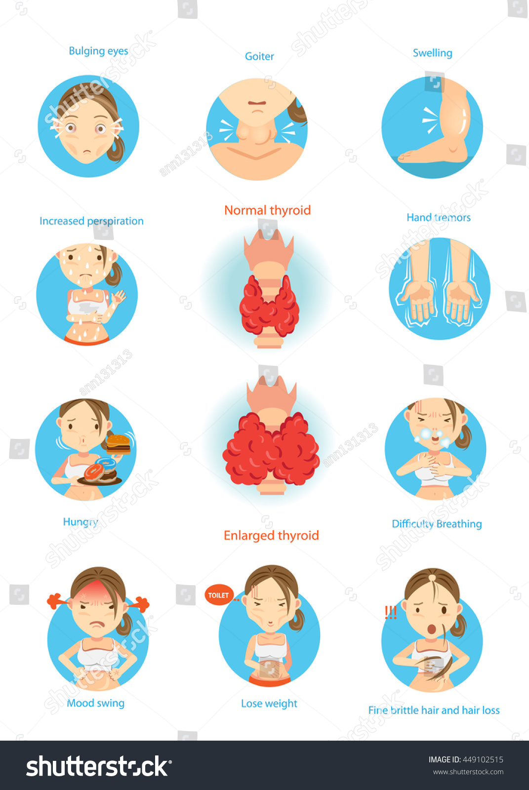 Symptoms Disease Hyperthyroidism Illustrations Circlecartoon Vector