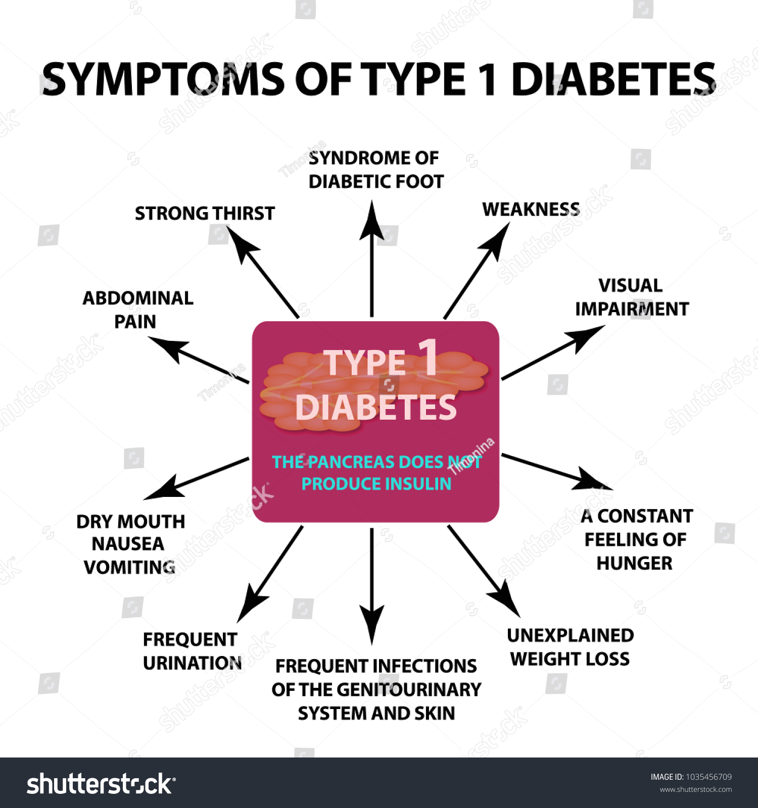 Symptoms Type 1 Diabetes Infographics Vector のベクター画像素材 ロイヤリティフリー