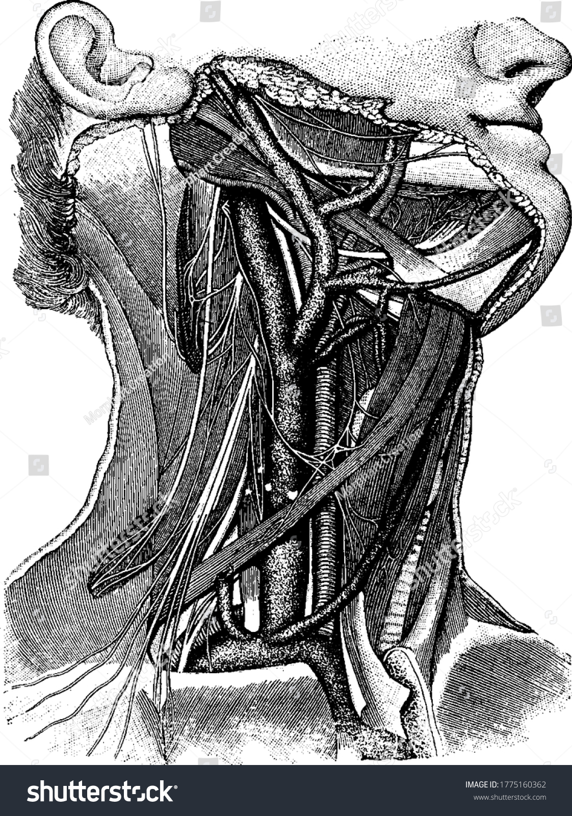 Blood Vessels Neck Showing Carotid Artery: vetor stock (livre de ...