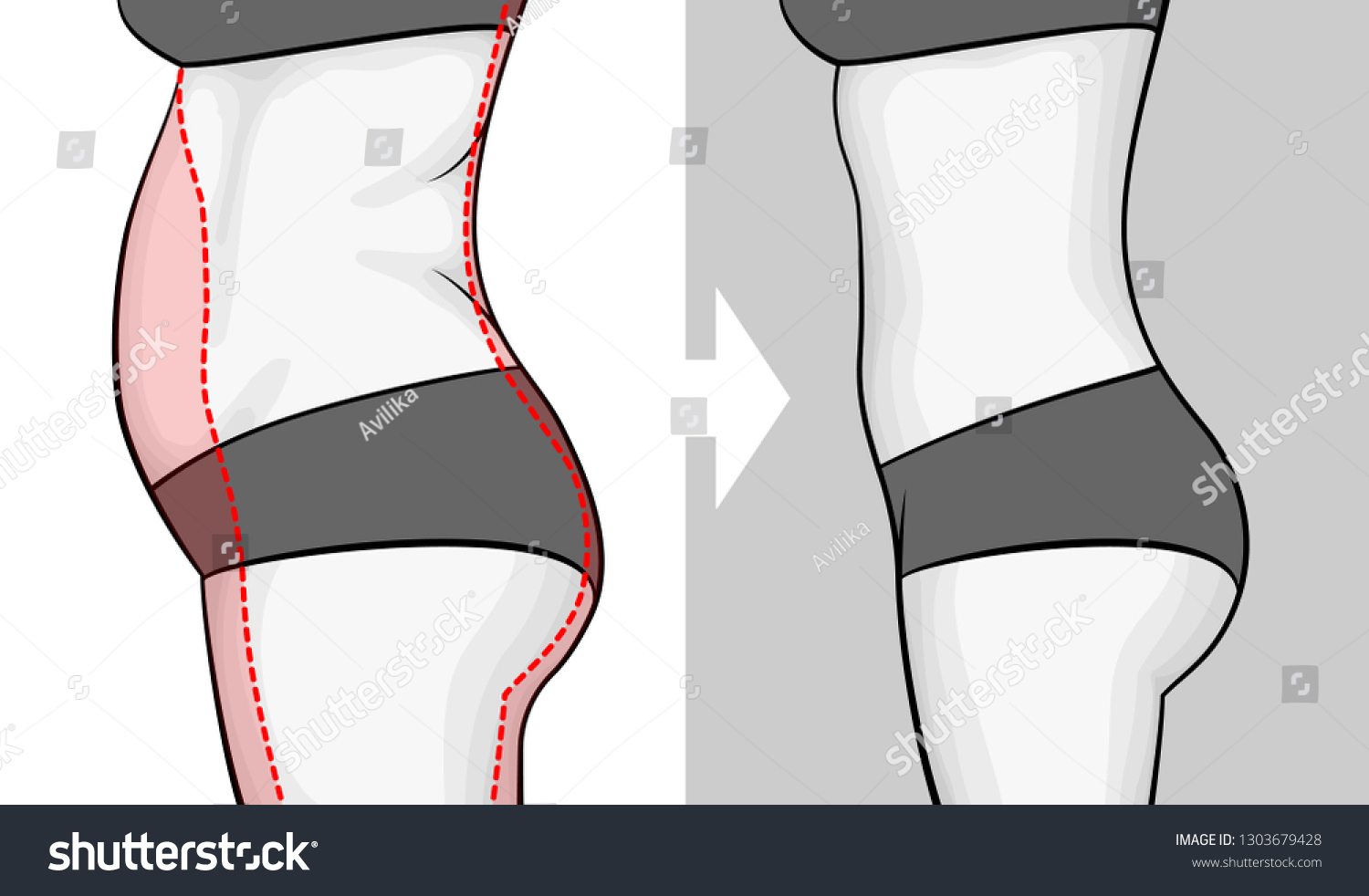 SVG of The body of a woman before and after losing weight. Belly view from side. Red outline showing excess weight. svg