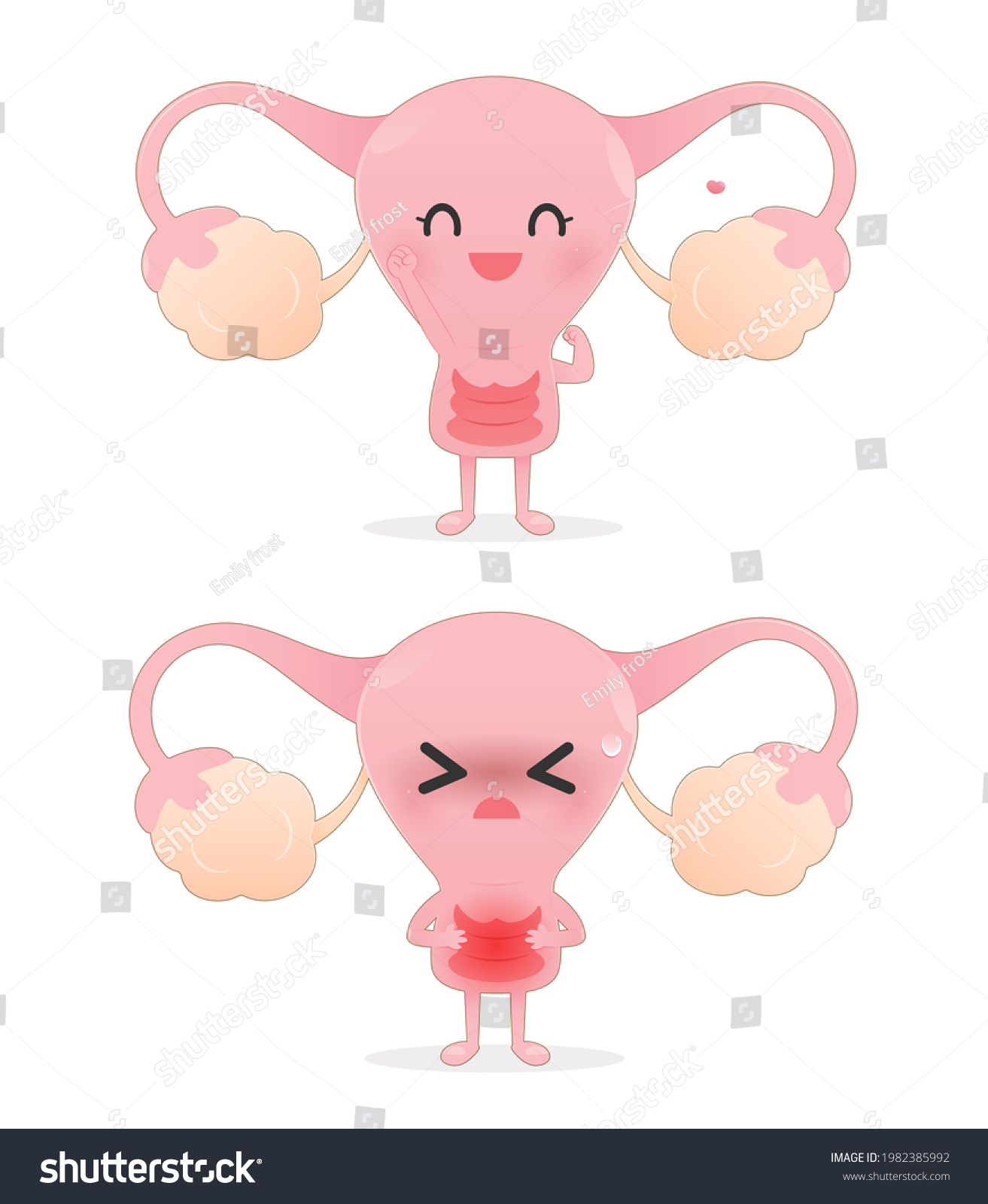 Strength Uterus Uterine Problems Miometrium Cartoon Stock Vector ...