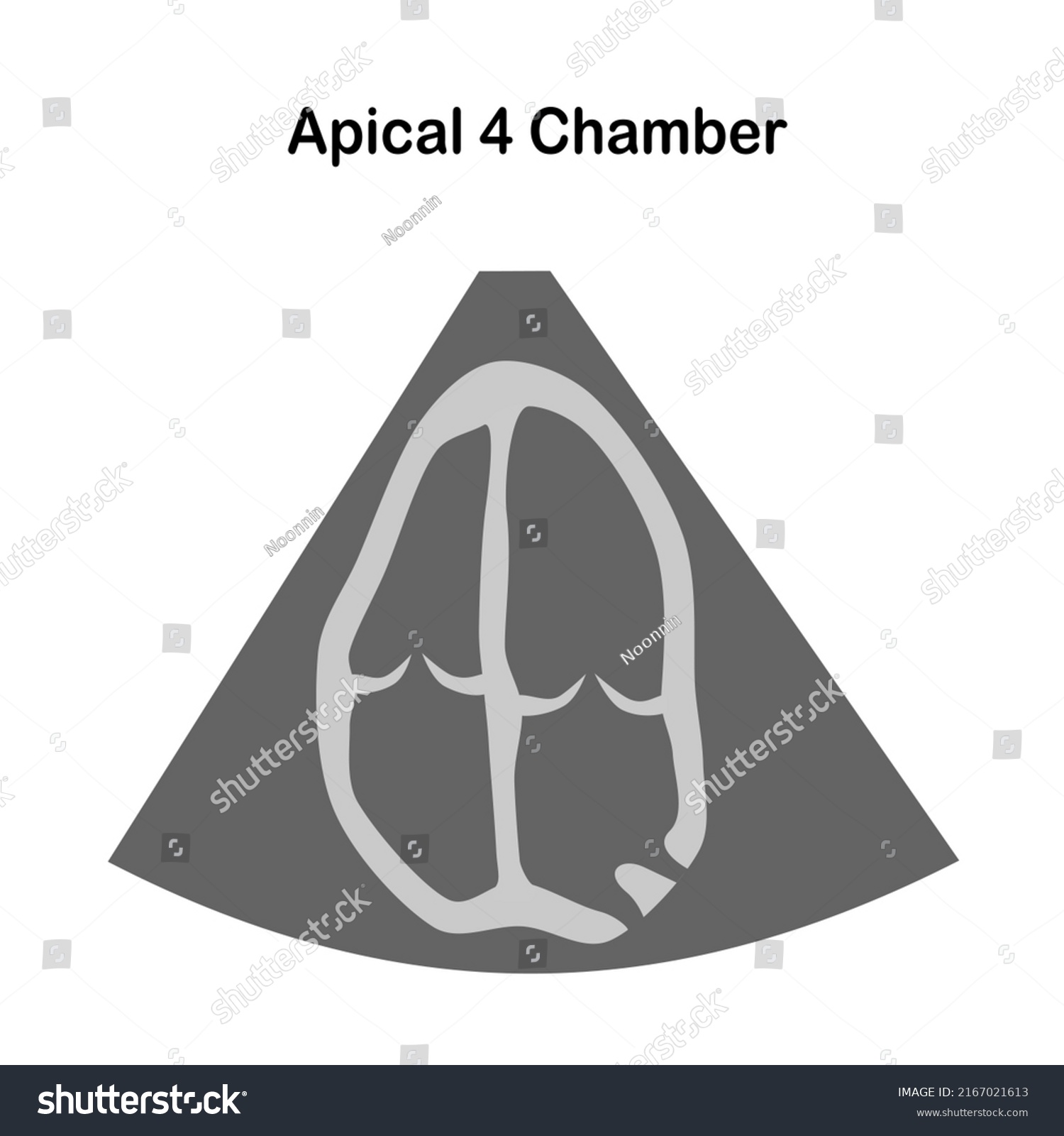 SVG of The Two-Dimensional Echocardiographic Examination.  Echocardiographic view: Apical 4 chamber svg
