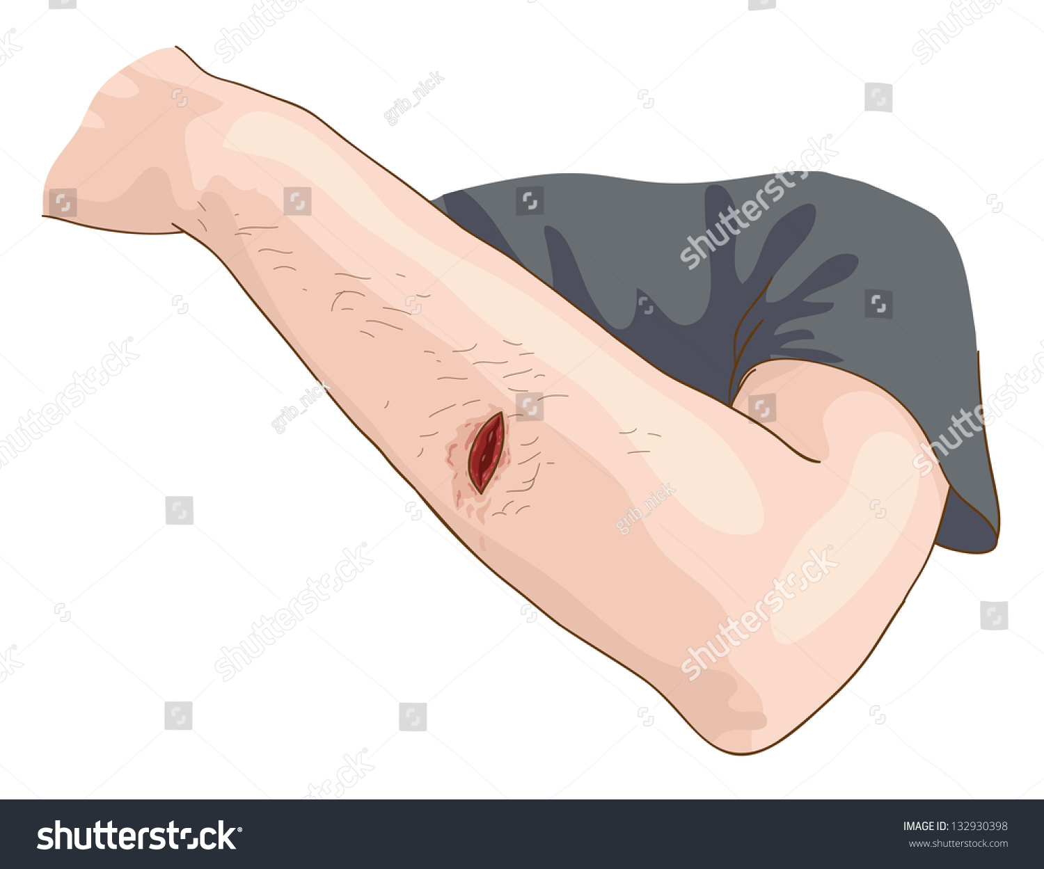 Wound Vector Illustration Stock Vector (Royalty Free) 132930398