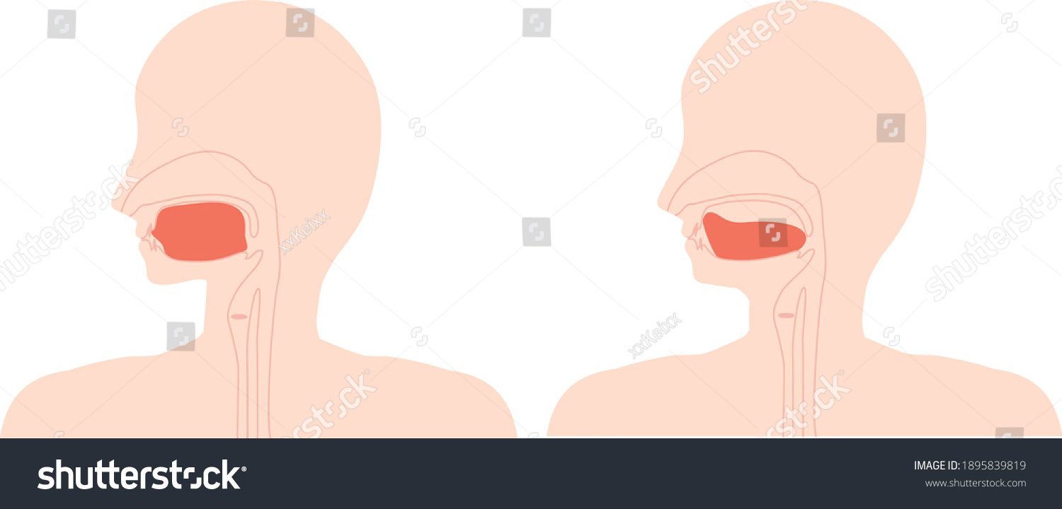 This Illustration Correct Tongue Position Low Stock Vector (Royalty ...