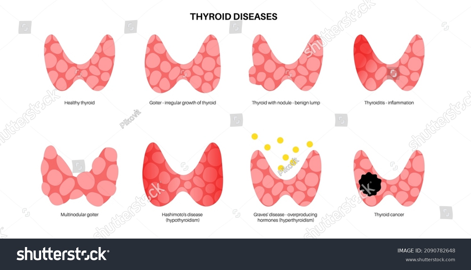 Thyroid Gland Diseases Endocrinology Clinic Concept Stock Vector Royalty Free 2090782648 1117