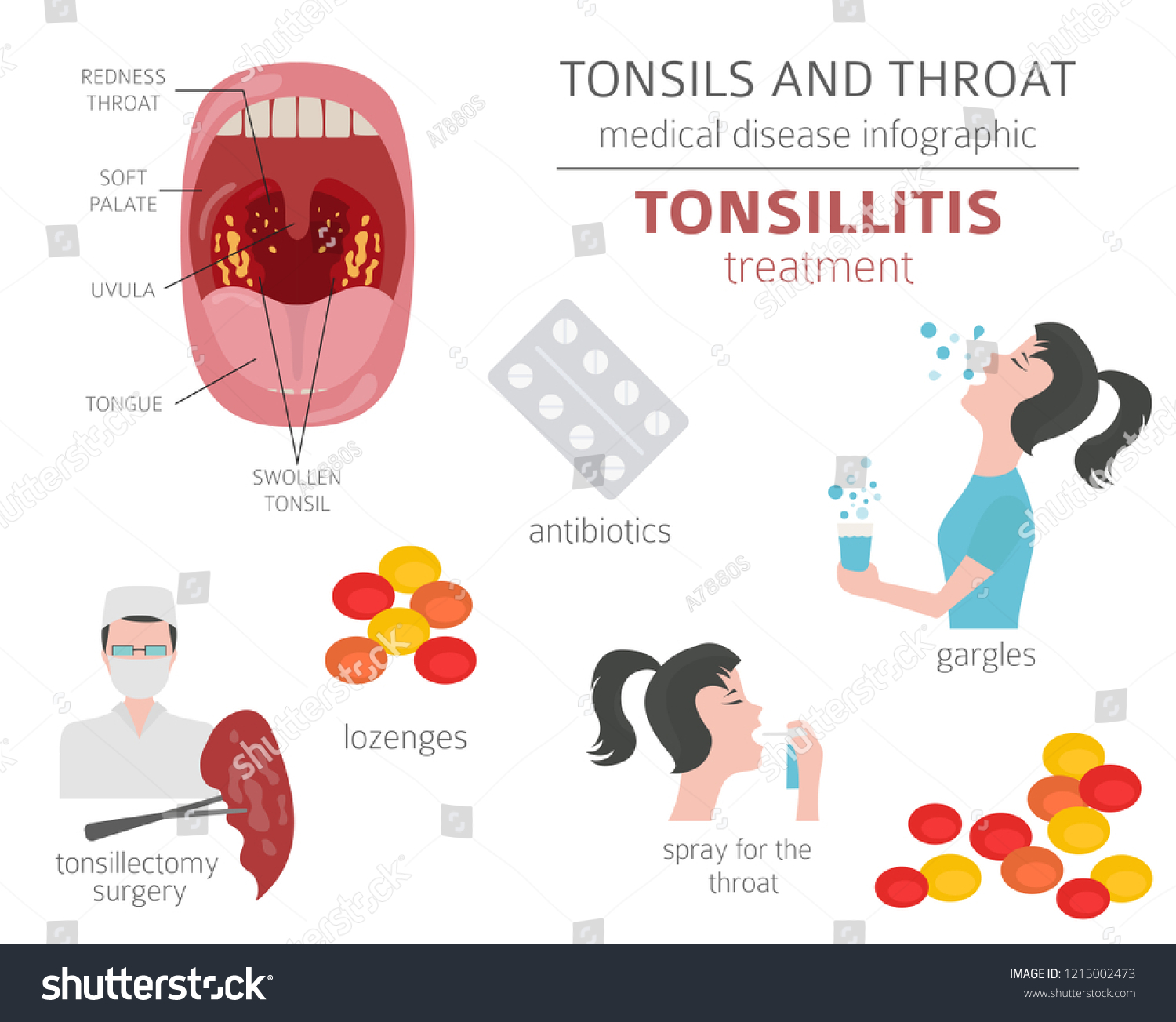 Tonsils Throat Diseases Tonsillitis Symptoms Treatment Stock Vector ...