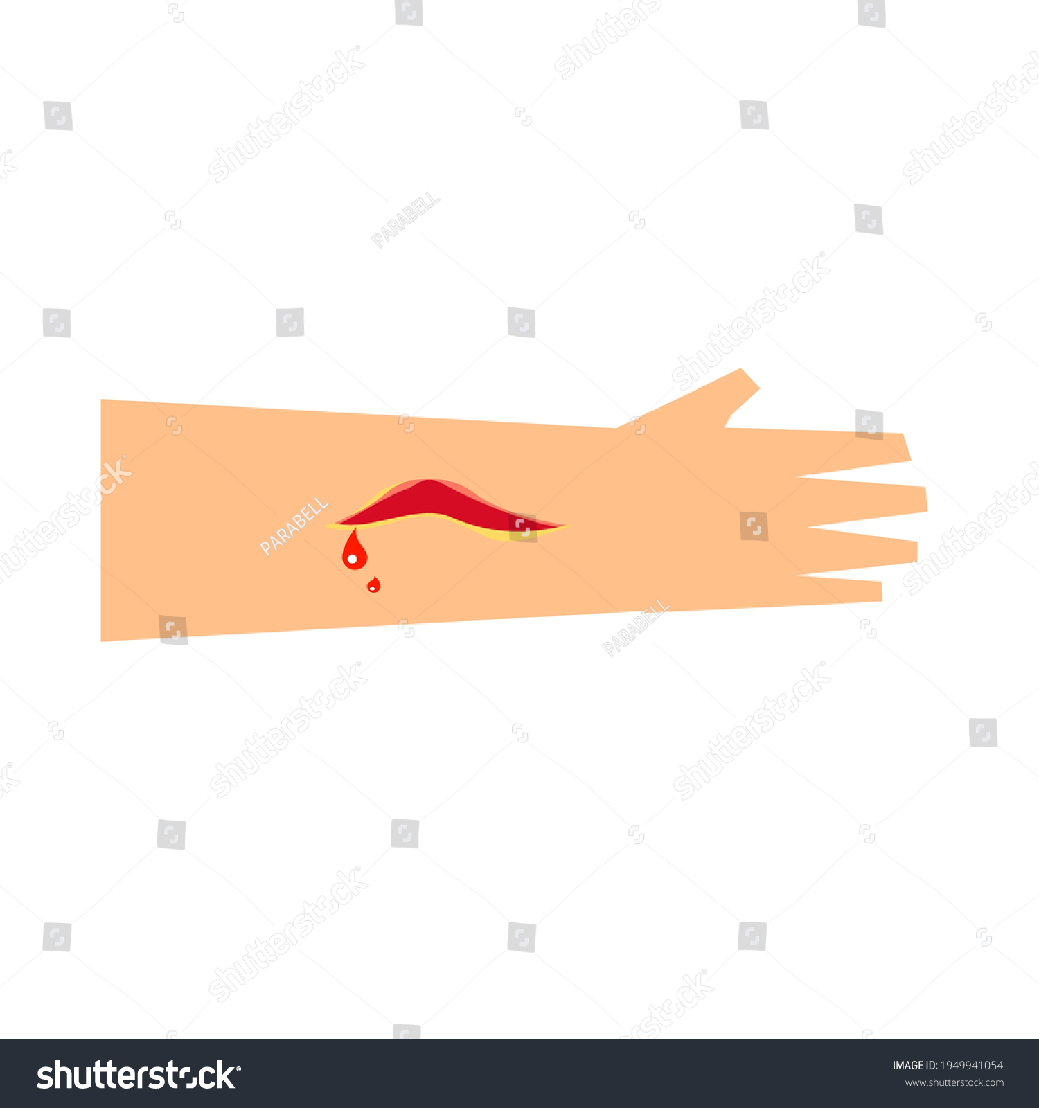 Top View Laceration Wound Forearm Stock Vector (Royalty Free ...