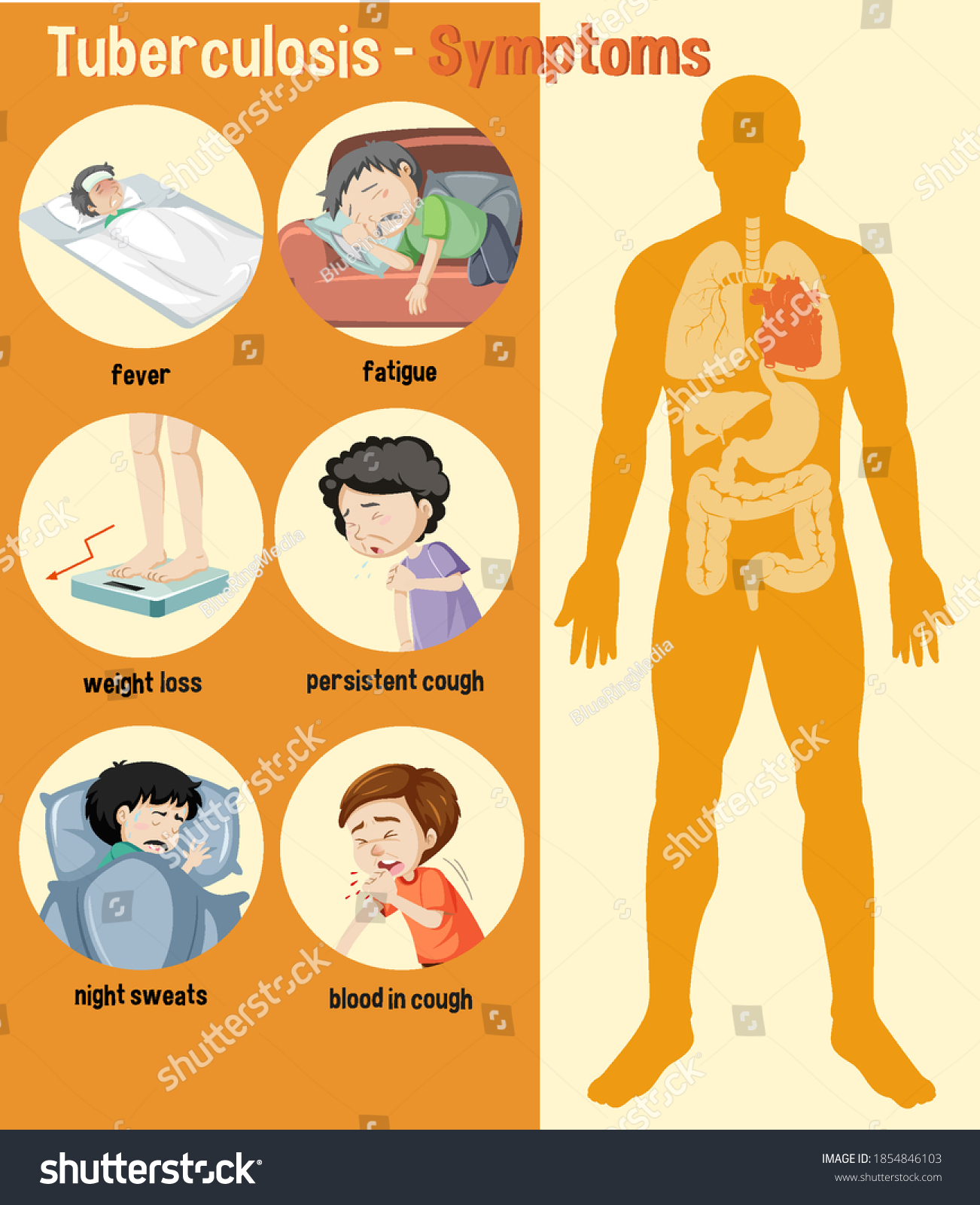 Tuberculosis Symptoms Information Infographic Illustration เวกเตอร์