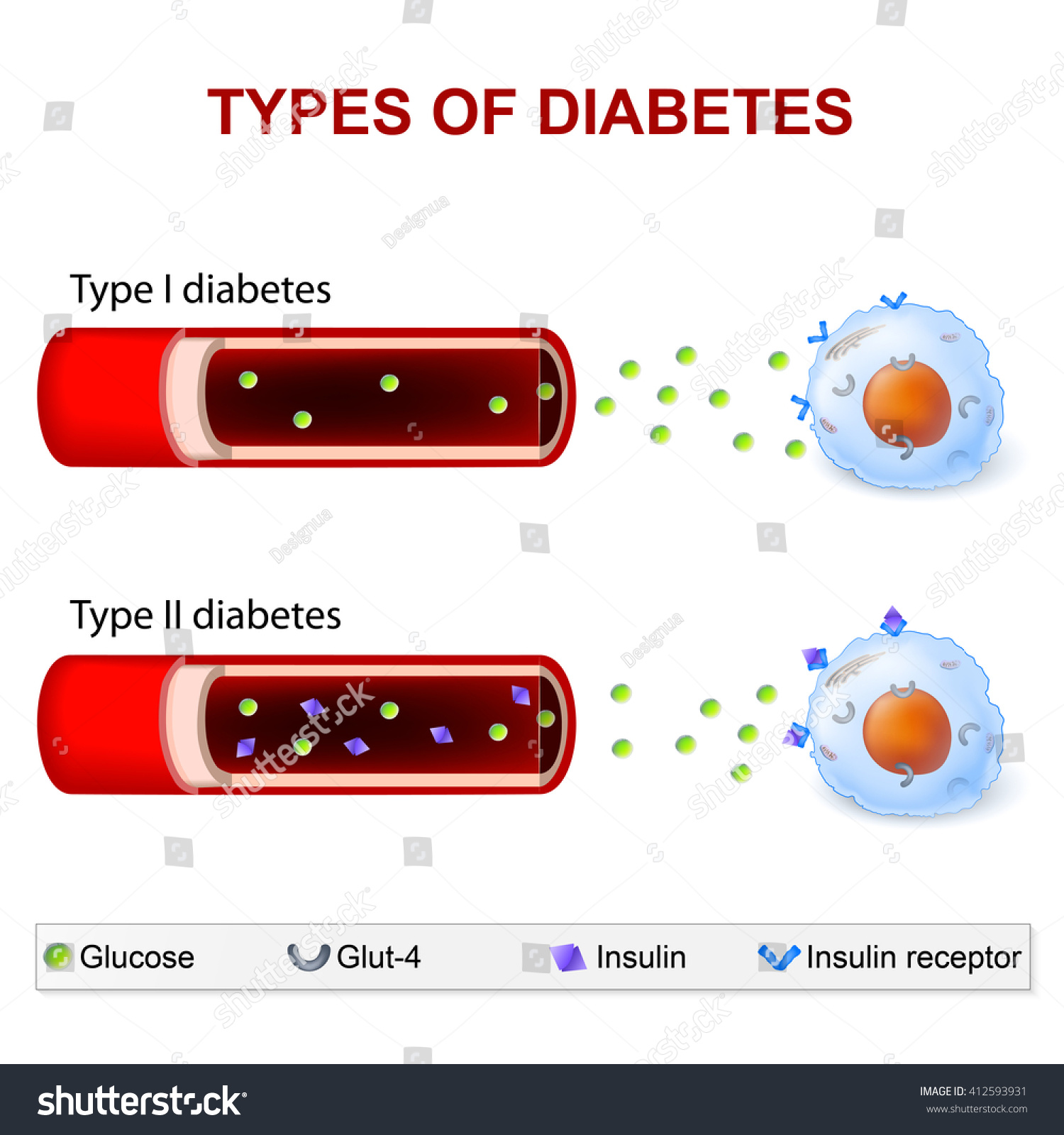 diabetes mellitus 2 1