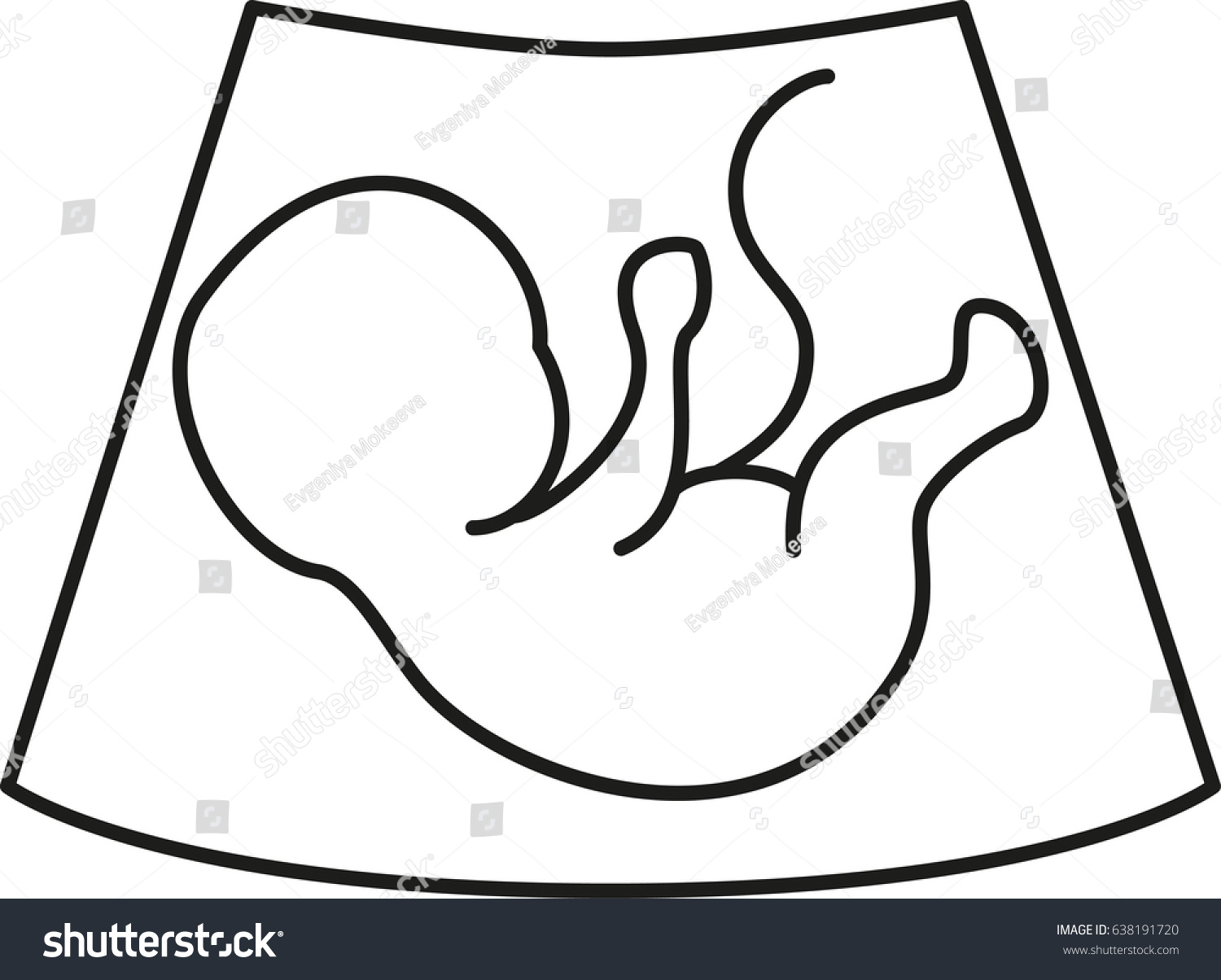 Ultrasonography Baby Icon Screening Baby Vector Stock Vector (Royalty ...