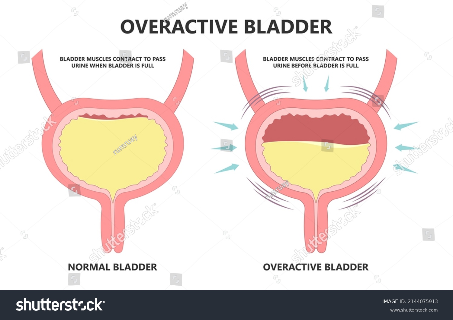 Urge Pass Urine Pelvic Floor Muscle Stock Vector (Royalty Free ...