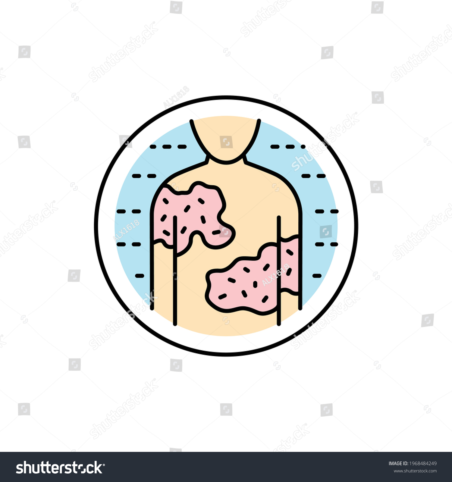 Urticaria Color Line Icon Dermatology Disease Stock Vector Royalty Free 1968484249 Shutterstock 6869