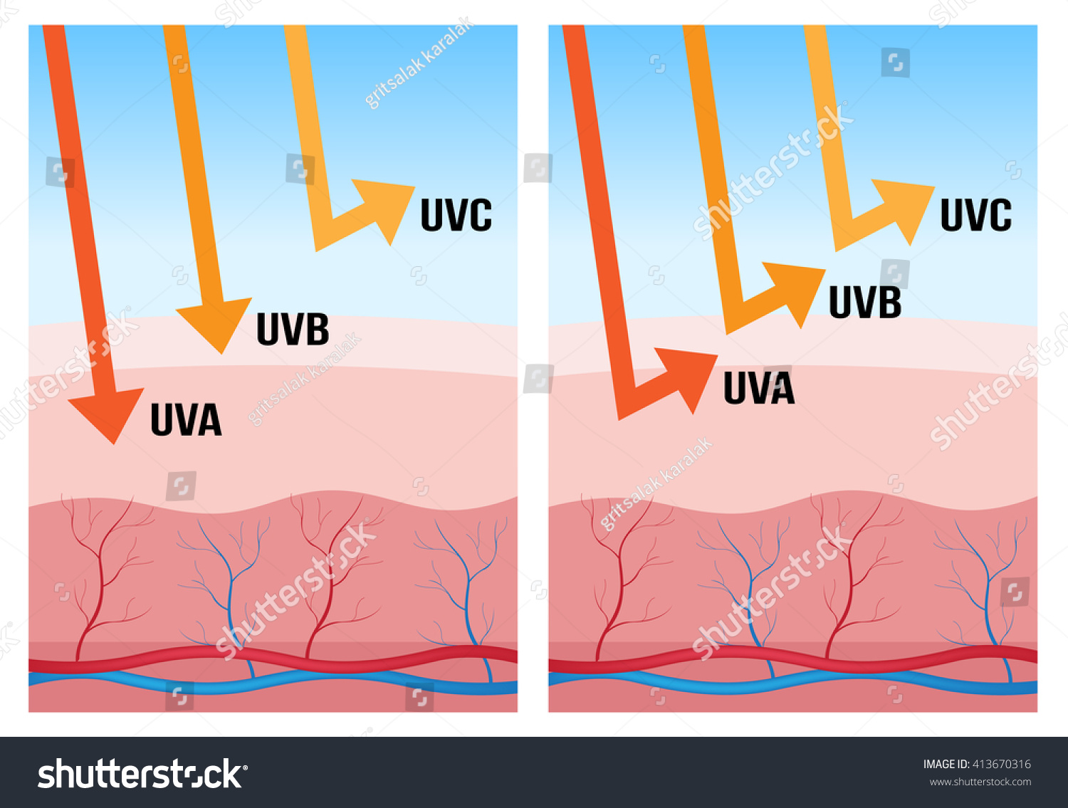 Uv 3 Type Rays Skin Ultraviolet Stock Vector (Royalty Free) 413670316